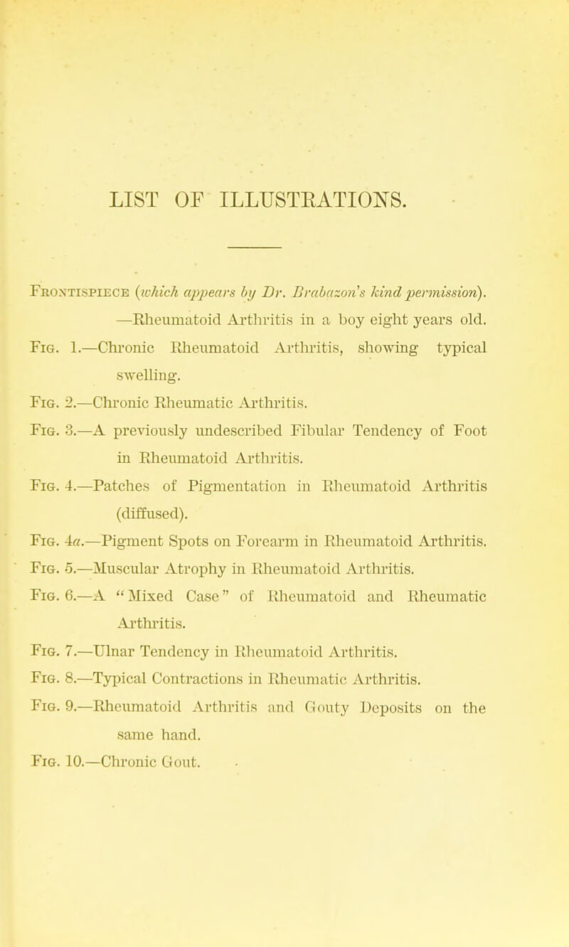 LIST OF ILLTJSTKATIONS. Frontispiece (which appears by Dr. Brabazon's kind permission). —Rheumatoid Arthritis in a boy eight years old. Fig. 1.—Chronic Rheumatoid Arthritis, showing typical swelling. Fig. 2.—Chronic Rheumatic Arthritis. Fig. 3.—A previously midescribed Fibular Tendency of Foot in Rheumatoid Arthritis. Fig. 4.—Patches of Pigmentation in Rheumatoid Arthritis (diffused). Fig. 4«.—Pigment Spots on Forearm in Rheumatoid Arthritis. Fig. o.—Muscular Atrophy in Rheumatoid Arthritis. Fig. 6.—A  Mixed Case of Rheumatoid and Rheumatic Arthritis. Fig. 7.—Ulnar Tendency in Rheumatoid Arthritis. Fig. 8.—Typical Contractions in Rheumatic Arthritis. Fig. 9.—Rheumatoid Arthritis and Gouty Deposits on the same hand. Fig. 10.—Chronic Gout.