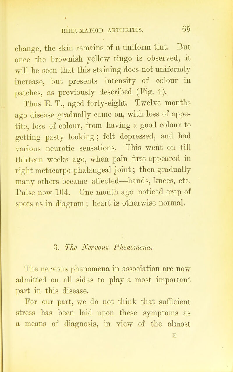 change, the skin remains of a uniform tint. But once the brownish yellow tinge is observed, it will be seen that this staining does not uniformly increase, but presents intensity of colour in patches, as previously described (Fig. 4). Thus E. T., aged forty-eight. Twelve months ago disease gradually came on, with loss of appe- tite, loss of colour, from having a good colour to getting pasty looking; felt depressed, and had various neurotic sensations. This went on till thirteen weeks ago, when pain first appeared in right metacarpo-phalangeal joint; then gradually many others became affected—hands, knees, etc. Pulse now 104. One month ago noticed crop of spots as in diagram ; heart is otherwise normal. 3. The Nervous Phenomena. The nervous phenomena in association are now admitted on all sides to play a most important part in this disease. For our part, we do not think that sufficient stress has been laid upon these symptoms as a means of diagnosis, in view of the almost E