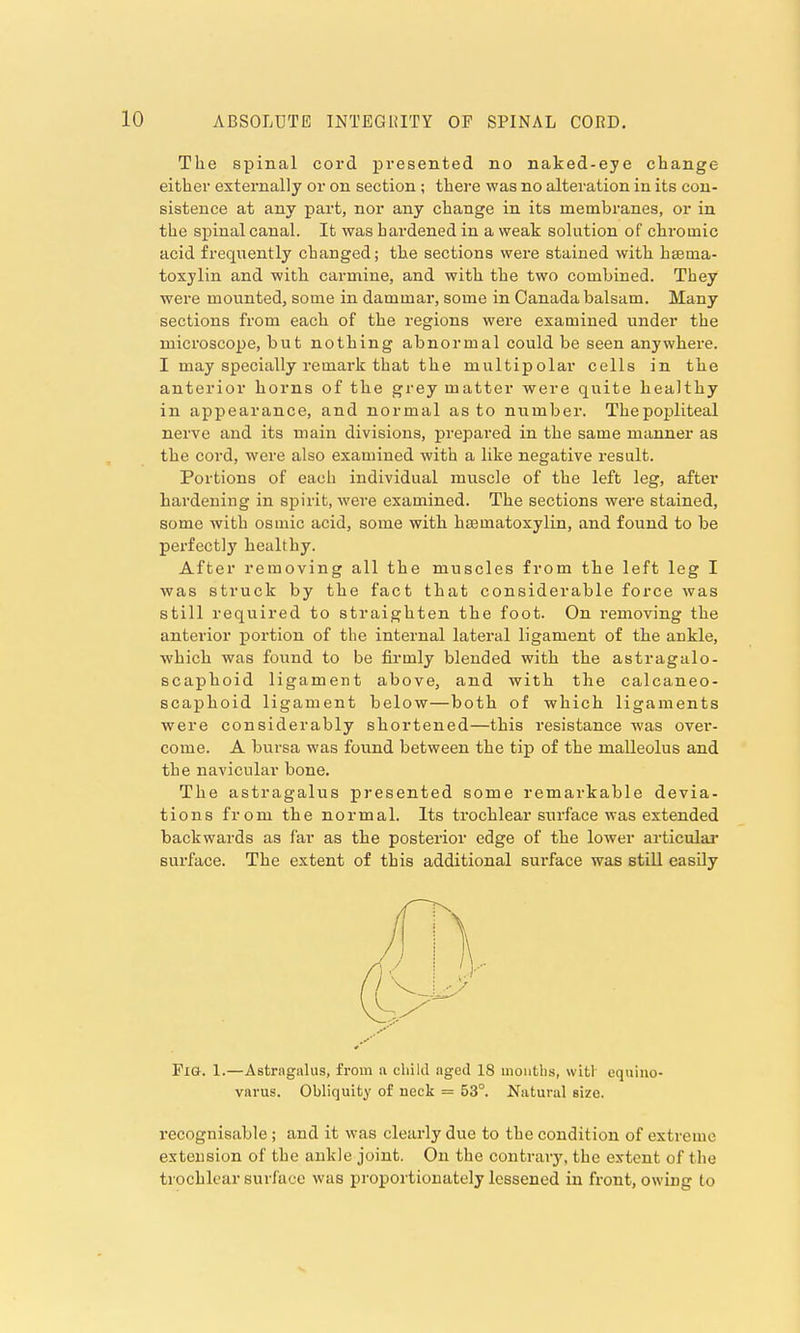 ABSOLUTE INTEGHITY Or SPINAL CORD. The spinal cord presented no naked-eye change either externally or on section ; there was no alteration in its con- sistence at any part, nor any change in its membranes, or in the spinal canal. It was hardened in a weak solution of chromic acid frequently changed; the sections were stained with hsema- toxylin and with carmine, and with the two combined. They were mounted, some in dammar, some in Canada balsam. Many sections from each of the regions were examined under the microscope, but nothing abnormal could be seen anywhere. I may specially remark that the multipolar cells in the anterior horns of the grey matter were quite healthy in appearance, and normal as to number. Thepopliteal nerve and its main divisions, prepared in the same manner as the cord, were also examined with a like negative result. Portions of each individual muscle of the left leg, after hardening in spirit, were examined. The sections were stained, some with osuiic acid, some with hsematoxylin, and found to be perfectly healthy. After removing all the muscles from the left leg I was struck by the fact that considerable force was still required to straighten the foot. On removing the anterior portion of the internal lateral ligament of the ankle, which was found to be firmly blended with the astragalo- scaphoid ligament above, and with the calcaneo- scaphoid ligament below—both of which ligaments were considerably shortened—this resistance was over- come. A bursa was found between the tip of the malleolus and the navicular bone. The astragalus j)resented some remarkable devia- tions from the normal. Its trochlear surface was extended backwards as far as the posterior edge of the lower articular surface. The extent of this additional sui'face was still easily Fig. 1.—AstMgalus, from a child aged 18 months, witl- cquino- varus. Obliquity of neck = 53°. Natural size. recognisable; and it was clearly due to the condition of extreme extension of the ankle joint. On the contrary, the extent of tlie trochlear surface was proportionately lessened in front, owing to