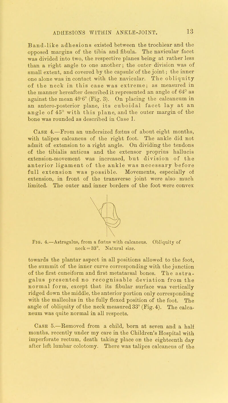 ADHESIONS WITHIN ANKLE-JOINT. Band-like adhesions existed between the troclilear and the opposed margins of the tibia and fibula. The navicular facet was divided into two, the respective planes being at rather less than a right angle to one another; the outer division was of small extent, and covered by the capsule'of the joint; the inner one alone was in contact with the navicular. The obliquity of the neck in this case was extreme; as measured in the manner hereafter described it represented an angle of 64° as against the mean 49'6° (Fig. 3). On placing the calcaneum in an antero-posterior plane, its cuboidal facet lay at an angle of 45° with this plane, and the outer margin of the bone was rounded as described in Case 1. Case 4.—From an undersized foetus of about eight months, with talipes calcaneus of the right foot. The ankle did not admit of extension to a right angle. On dividing the tendons of the tibialis anticus and the extensor proprius hallucis extension-movement was increased, but division of the anterior ligament of the ankle was necessary before full extension was possible. Movements, especially of extension, in front of the transverse joint were also much limited. The outer and inner borders of the foot were convex Fig. 4.—Astragalus, from a fojtus with calcaneus. Obliquity of neck = 33°. Natural size. towards the plantar aspect in all positions allowed to the foot, the summit of the inner curve corresponding with the junction of the first cuneiform and first metatarsal bones. The astra- galus presented no recognisable deviation from the normal form, except that its fibular surface was vertically ridged down the middle, the anterior portion only corresponding with the malleolus in the fully flexed position of the foot. The angle of obliquity of the neck measured 33° (Fig. 4). The calca- neum was quite normal in all respects. Case 5.—Removed from a child, born at seven and a half months, recently under my care in the Children's Hospital with imperforate rectum, death taking place on the eighteenth day after left lumbar colotomy. There was talipes calcaneus of the