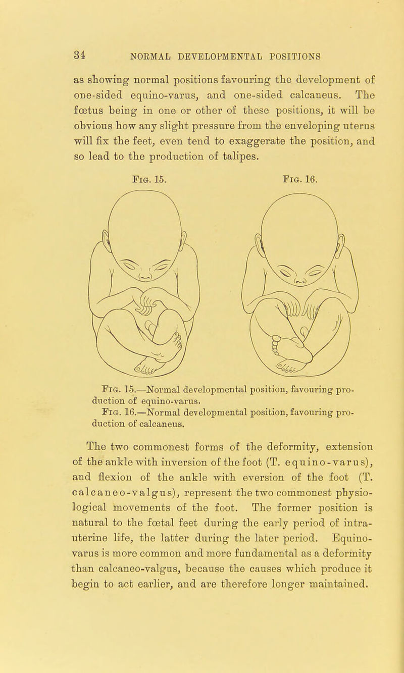 as showiug normal positions favouring tlie development of one-sided equino-varus^ and one-sided calcaneus. The foetus being in one or other of these positions, it will be obvious how any slight pressure from the enveloping uterus will fix the feet, even tend to exaggerate the position, and so lead to the production of talipes. Fig. 15. Fig. 16. Fig. 15.—Normal dev^elopmental position, favouring pro- duction of equino-varus. Fig. 16.—Normal developmental position, favouring pro- duction of calcaneus. The two commonest forms of the deformity, extension of the ankle with inversion of the foot (T. equino-varus), and flexion of the ankle with eversion of the foot (T. calcaneo-valgus), represent the two commonest physio- logical movements of the foot. The former position is natural to the fcetal feet during the early period of intra- uterine life, the latter during the liater period. Equino- varus is more common and more fundamental as a defoi'mity than calcaneo-valgus, because the causes which produce it begin to act earlier, and are therefore longer maintained.