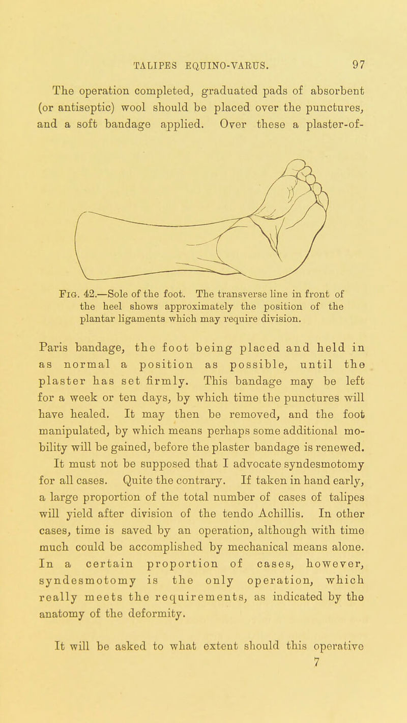 The operation completed, graduated pads of absorbent (or antiseptic) wool should be placed over the punctures, and a soft bandage applied. Over these a plaster-of- FiG. 42.—Sole of tlie foot. The transverse line in front of tlie heel shows approximately the position of the plantar ligaments which may require division. Paris bandage, the foot being placed and held in as normal a position as possible, until the plaster has set firmly. This bandage may be left for a week or ten days, by which time the punctures will have healed. It may then be removed, and the foot manipulated, by which means perhaps some additional mo- bility will be gained, before the plaster bandage is renewed. It must not be supposed that I advocate syndesmotomy for all cases. Quite the contrary. If taken in hand early, a large proportion of the total number of cases of talipes will yield after division of the tendo Achillis. In other cases, time is saved by an operation, although with time much could be accomplished by mechanical means alone. In a certain proportion of cases, however, syndesmotomy is the only operation, which really meets the requirements, as indicated by the anatomy of the deformity. It will be asked to what extent should this operative 7