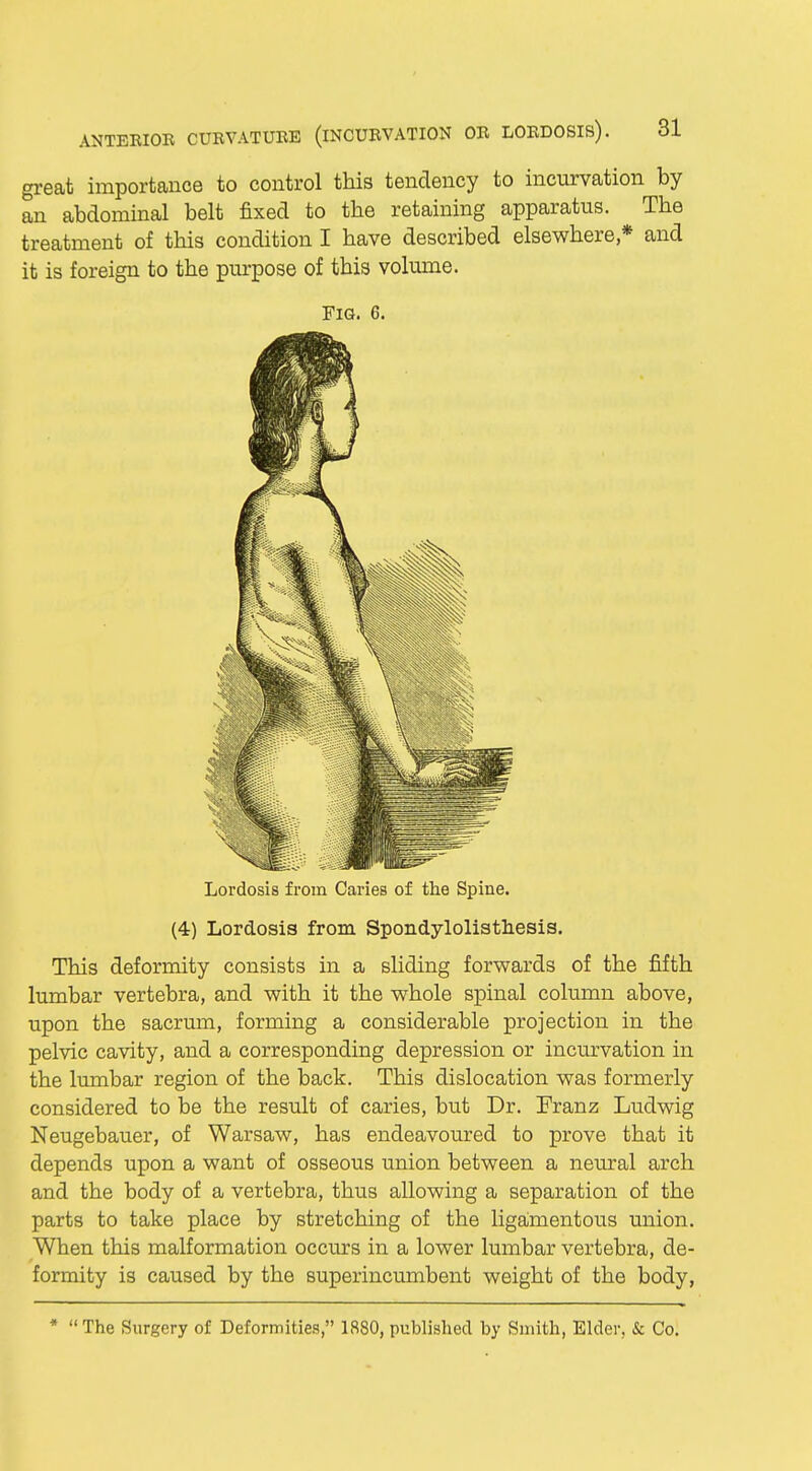 great importance to control this tendency to incurvation by an abdominal belt fixed to the retaining apparatus. The treatment of this condition I have described elsewhere * and it is foreign to the purpose of this volume. This deformity consists in a sliding forwards of the fifth lumbar vertebra, and with it the whole spinal column above, upon the sacrum, forming a considerable projection in the pelvic cavity, and a corresponding depression or incurvation in the lumbar region of the back. This dislocation was formerly considered to be the result of caries, but Dr. Franz Ludwig Neugebauer, of Warsaw, has endeavoured to prove that it depends upon a want of osseous union between a neural arch and the body of a vertebra, thus allowing a separation of the parts to take place by stretching of the ligamentous union. When this malformation occurs in a lower lumbar vertebra, de- formity is caused by the superincumbent weight of the body, * The Surgery of Deformities, 1880, published by Smith, Elder, & Co. FIG. 6. Lordosis from Caries of the Spine. (4) Lordosis from Spondylolisthesis.