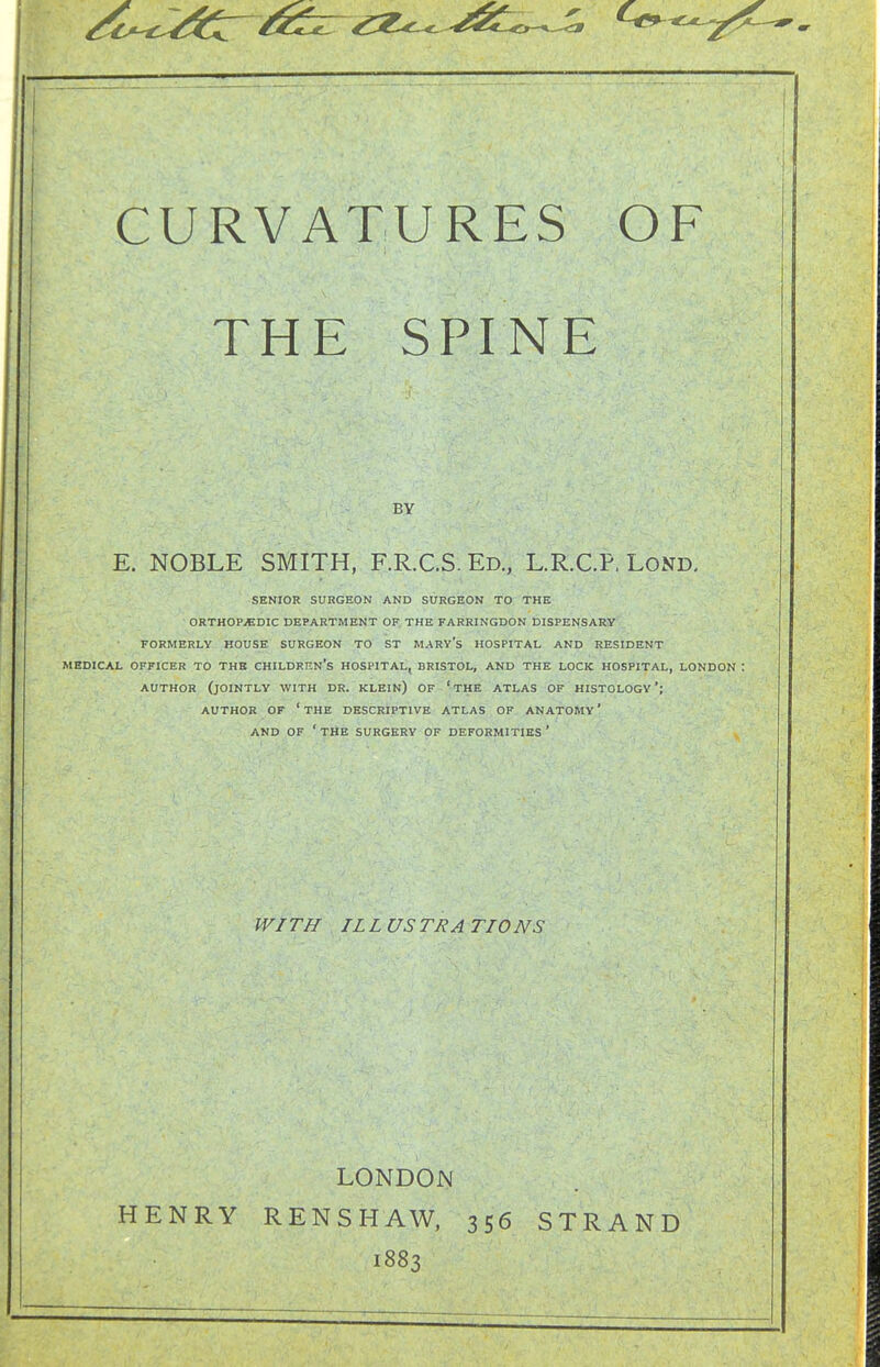 ^C'-^^^^Z^ /^cT^ ^^^^^^ -^^^o-*-^ CURVATURES OF THE SPINE BY E. NOBLE SMITH, F.R.C.S. Ed., L.R.C.P. Lond, SENIOR SURGEON AND SURGEON TO THE ORTHOP/EDIC DEPARTMENT OF THE FARRINGDON DISPENSARY FORMERLY HOUSE SURGEON TO ST MARY's HOSPITAL AND RESIDENT MEDICAL OFFICER TO THE CHILDREN'S HOSPITAL, BRISTOL, AND THE LOCK HOSPITAL, LONDON I AUTHOR (jointly WITH DR. KLEIN) OF ' THE ATLAS OF HISTOLOGY '; AUTHOR OF 'the DESCRIPTIVE ATLAS OF ANATOMY' AND OF 'the SURGERY OF DEFORMITIES' WITH ILLUSTRATIONS LONDON 1883