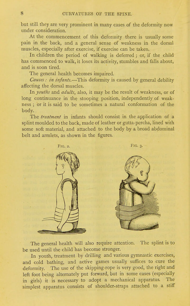 but still they are very prominent in many cases of the deformity now under consideration. At the commencement of this deformity there is usually some pain in the back, and a general sense of weakness in the dorsal muscles, especially after exercise, if exercise can be taken. In children the period of walking is deferred ; or, if the child has commenced to walk, it loses its activity, stumbles and falls about, and is soon tired. The general health becomes impaired. Causes: in infants.—This deformity is caused by general debility affecting the dorsal muscles. In youths and adults, also, it may be the result of weakness, or of long continuance in the stooping position, independently of weak- ness ; or it is said to be sometimes a natural conformation of the body. The treatment in infants should consist in the application of a splint moulded to the back, made of leather or gutta-percha, lined with some soft material, and attached to the body by a broad abdominal belt and armlets, as shown in the figures. The general health will also require attention. The splint is to be used until the child has become stronger. In youth, treatment by drilling and various gymnastic exercises, and cold bathing, and active games usually suffices to cure the deformity. The use of the skipping-rope is very good, the right and left foot being alternately put forward, but in some cases (especially in girls) it is necessary to adopt a mechanical apparatus. The simplest apparatus consists of shoulder-straps attached to a stiff Fig. 2. Fig. 3.