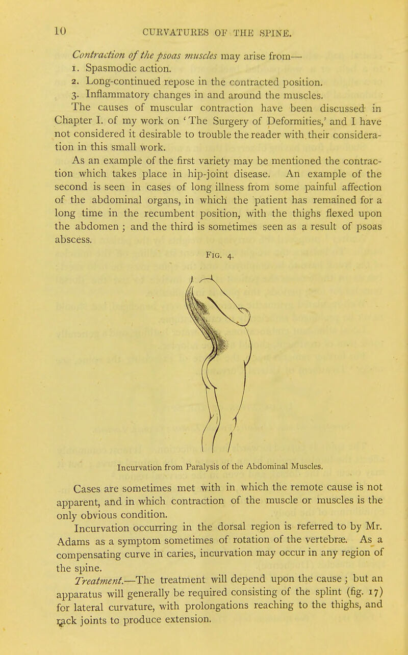 Co7itraction of the psoas muscles may arise from— 1. Spasmodic action. 2. Long-continued repose in the contracted position. 3. Inflammatory changes in and around the muscles. The causes of muscular contraction have been discussed in Chapter I. of my work on ' The Surgery of Deformities,' and I have not considered it desirable to trouble the reader with, their considera- tion in this small work. As an example of the first variety may be mentioned the contrac- tion which takes place in hip-joint disease. An example of the second is seen in cases of long illness from some painful affection of the abdominal organs, in which the patient has remained for a long time in the recumbent position, with the thighs flexed upon the abdomen ; and the third is sometimes seen as a result of psoas abscess. Fig. 4. Incurvation from Paralysis of the Abdominal Muscles. Cases are sometimes met with in which the remote cause is not apparent, and in which contraction of the muscle or muscles is the only obvious condition. Incurvation occurring in the dorsal region is referred to by Mr. Adams as a symptom sometimes of rotation of the vertebrae. As a compensating curve in caries, incurvation may occur in any region of the spine. Treah?tent.—The treatment will depend upon the cause ; but an apparatus will generally be required consisting of the splint (fig. 17) for lateral curvature, with prolongations reaching to the thighs, and :;^ck joints to produce extension.