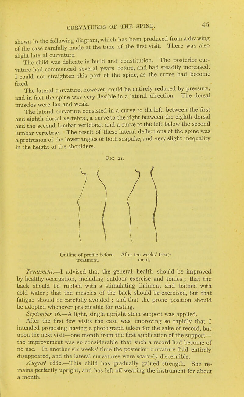 shown in the following diagram, which has been produced from a drawing of the case carefully made at the time of the first visit. There was also slight lateral curvature. The child was delicate in build and constitution. The posterior cur- vature had commenced several years before, and had steadily increased. I could not straighten this part of the spine, as the curve had become fixed. The lateral curvature, however, could be entirely reduced by pressure, and in fact the spine was very flexible in a lateral direction. The dorsal muscles were lax and weak. The lateral curvature consisted in a curve to the left, between the first and eighth dorsal vertebrae, a curve to the right between the eighth dorsal and the second lumbar vertebrae, and a curve to the left below the second lumbar vertebrae. The result of these lateral deflections of the spine was a protrusion of the lower angles of both scapulae, and very slight inequality in the height of the shoulders. Fig, 21. Outline of profile before After ten weeks' treat- treatment, ment. Treatimnt.—I advised that the general health should be improved by healthy occupation, including outdoor exercise and tonics ; that the back should be rubbed with a stimulating liniment and bathed with Cold water; that the muscles of the back should be exercised, but that fatigue should be carefully avoided ; and that the prone position should be adopted whenever practicable for resting. September 16.—A light, single upright stem support was applied. After the first few visits the case was improving so rapidly that I intended proposing having a photograph taken for the sake of record, but upon the next visit—one month from the first application of the support— the improvement was so considerable that such a record had become cf no use. In another six weeks' time the posterior curvature had entirely disappeared, and the lateral curvatures were scarcely discernible. August 1882.—This child has gradually gained strength. She re- mains perfectly upright, and has left off wearing the instrument for about a month.