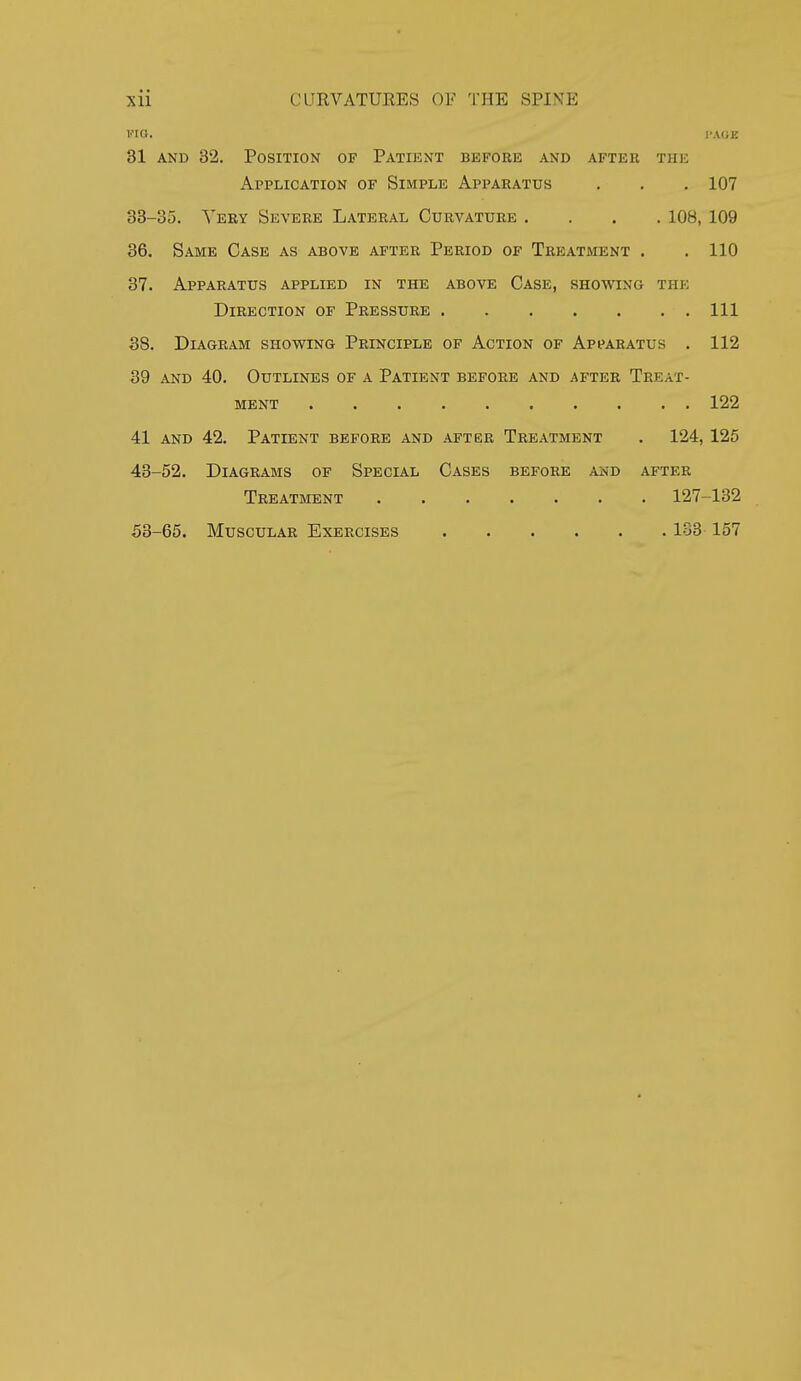 I''ia. I'AOE 31 AND 32. Position of Patient before and after the Application of Simple Apparatus . . , 107 38-35. Yery Severe Lateral Curvature .... 108, 109 36. Same Case as above after Period of Treatment . . 110 37. Apparatus applied in the above Case, showing the Direction of Pressure Ill 38. Diagram showing Principle of Action of Apparatus . 112 39 AND 40. Outlines of a Patient before and after Treat- ment 122 41 AND 42. Patient before and after Treatment . 124, 125 43-52. Diagrams of Special Cases before and after Treatment 127-132 53-65. Muscular Exercises 133 157