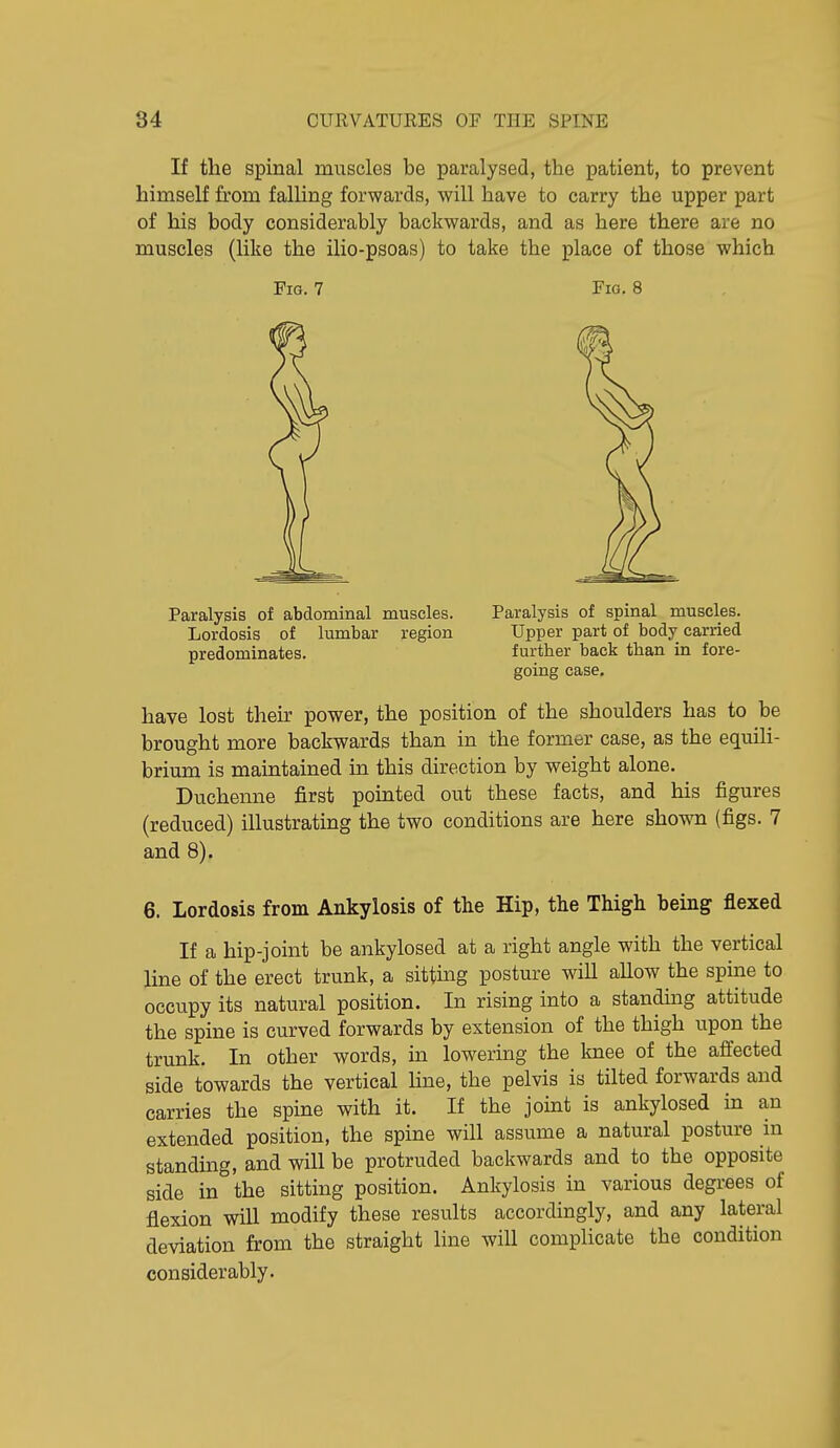 If the spinal muscles be paralysed, the patient, to prevent himself from falling forwards, will have to carry the upper part of his body considerably backwards, and as here there are no muscles (like the ilio-psoas) to take the place of those which Pig. 7 Fio. 8 Paralysis of abdominal muscles. Lordosis of lumbar region predominates. Paralysis of spinal muscles. Upper part of body carried further back than in fore- going case. have lost their power, the position of the shoulders has to be brought more backwards than in the former case, as the equili- brium is maintained in this direction by weight alone. Duchenne first pointed out these facts, and his figures (reduced) illustrating the two conditions are here shown (figs. 7 and 8). 6. Lordosis from Ankylosis of the Hip, the Thigh being flexed If a hip-joint be ankylosed at a right angle with the vertical line of the erect trunk, a sitting posture will allow the spine to occupy its natural position. In rising into a standing attitude the spine is curved forwards by extension of the thigh upon the trunk. In other words, in lowering the knee of the affected side towards the vertical line, the pelvis is tilted forwards and carries the spine with it. If the joint is ankylosed in an extended position, the spine will assume a natural posture in standing, and will be protruded backwards and to the opposite side in the sitting position. Ankylosis in various degrees of flexion will modify these results accordingly, and any lateral deviation from the straight line will complicate the condition considerably.