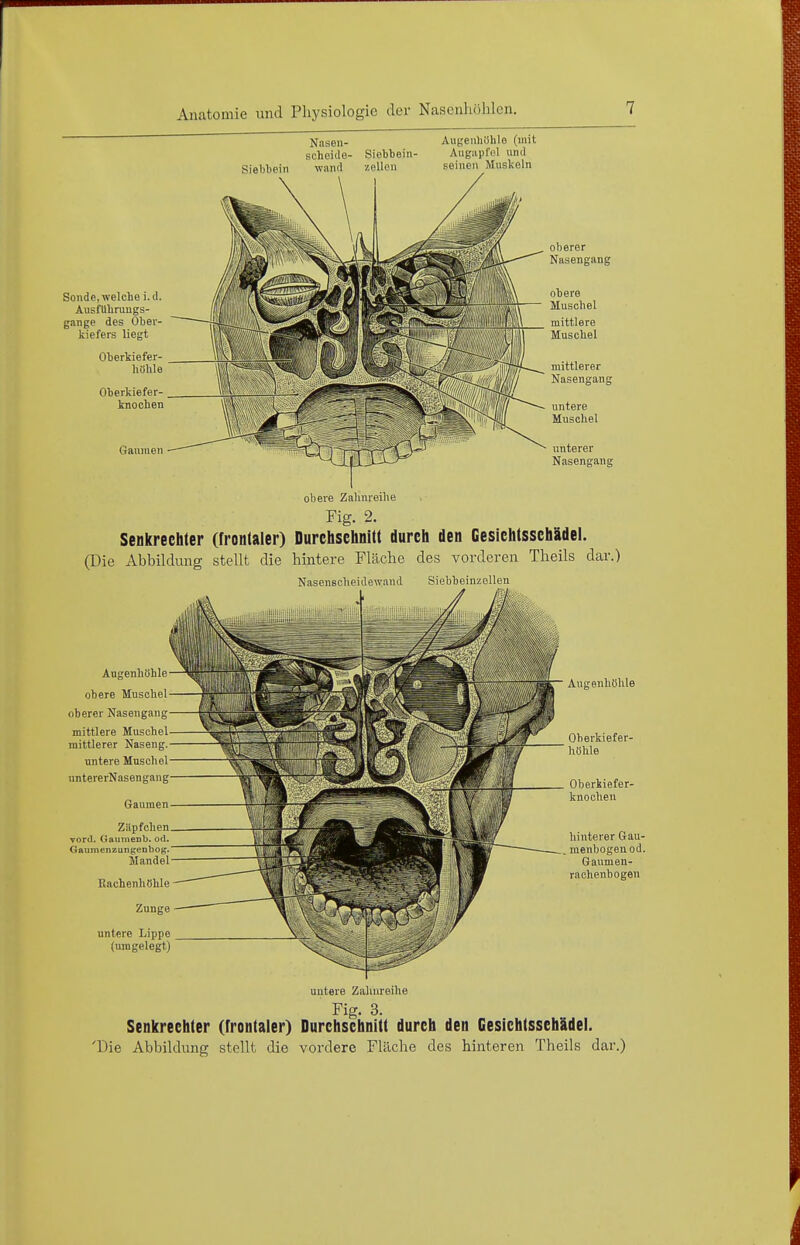 Nasen- scheide Siebbein wancl Siebbein- zoUcn Augenhöhle (mit Augiipfnl und seinen Muskeln Sonde, welche i.d. Aushlhruugs- gange des Ober- kiefers liegt Oberkiefer- hüble Oberkiefer- knochen Ganmen oberer Nasengang obere Muschel mittlere Muschel unterer Nasengang obere Zahnreihe Fig. 2. Senkrechter (frontaler) Durchschnitt durch den Gesichtsschldel. (Die Abbildung stellt die hintere Fläche des vorderen Theils dar.) Nasenscheidewand SiebbemzoUen Augenhöhle obere Muschel oberer Nasengang mittlere Muschel mittlerer Naseng. untere Muschel untererNasengang Gaumen Zäpfchen Tord. GaumeDb. od. Gftumenzungenbog. Mandel Kachenliöhle Zunge untere Lippe (umgelegt) Augenhöhle Oberkiefer- höhle Oberkiefer- knoohen hinterer Gau- menbogen od. Gaumen- raohenbogen untere Zahnreihe Fig. 3. Senkrechter (frontaler) Durchschnitt durch den Gesichtsschädel. 'Die Abbildung stellt die vordere Fläche des hinteren Theils dar.)