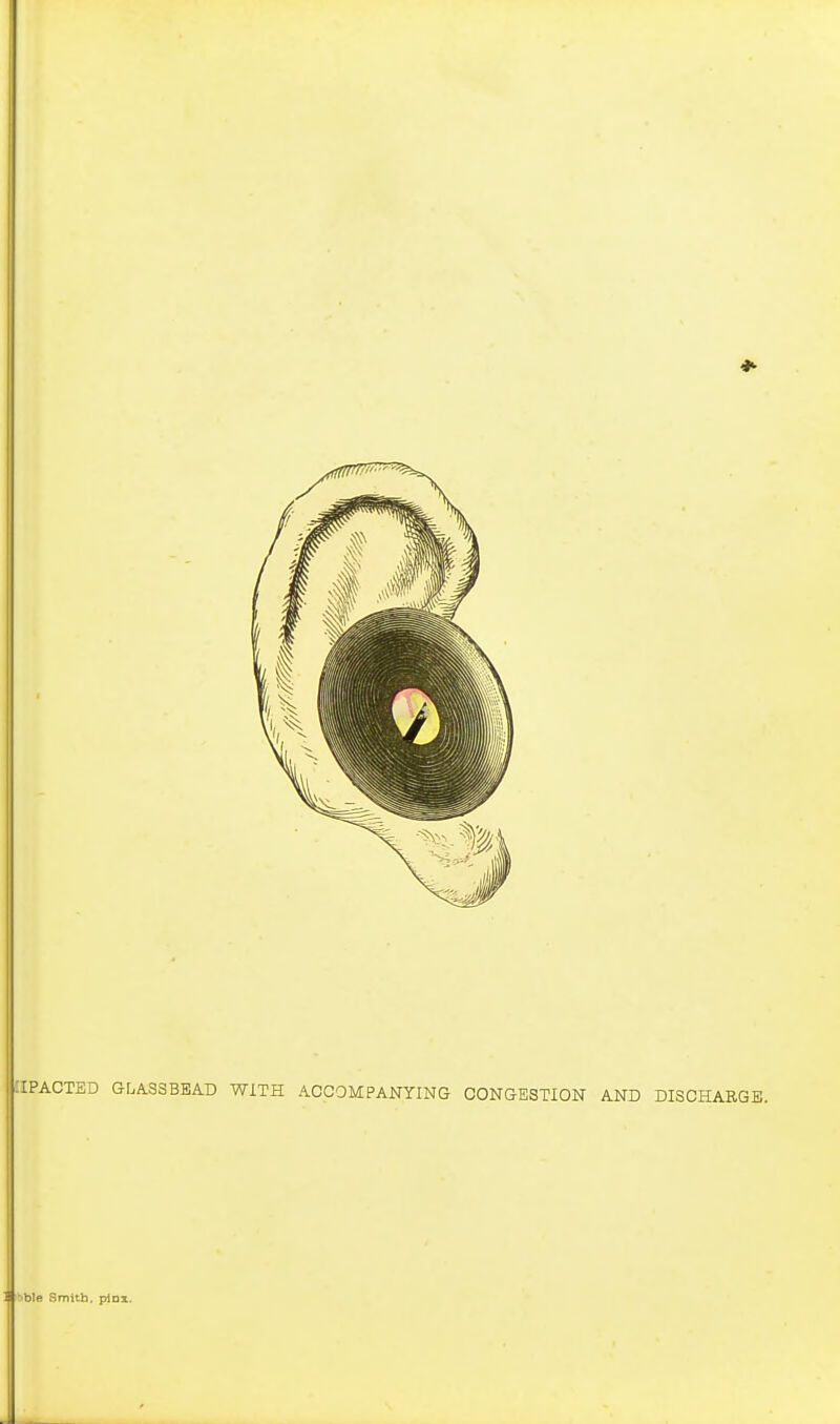 aPACTED Gr.ASSBEAD WITH ACCOMPANYING CONGESTION AND DISCHARGE. ] Tblft Smith, pinx.