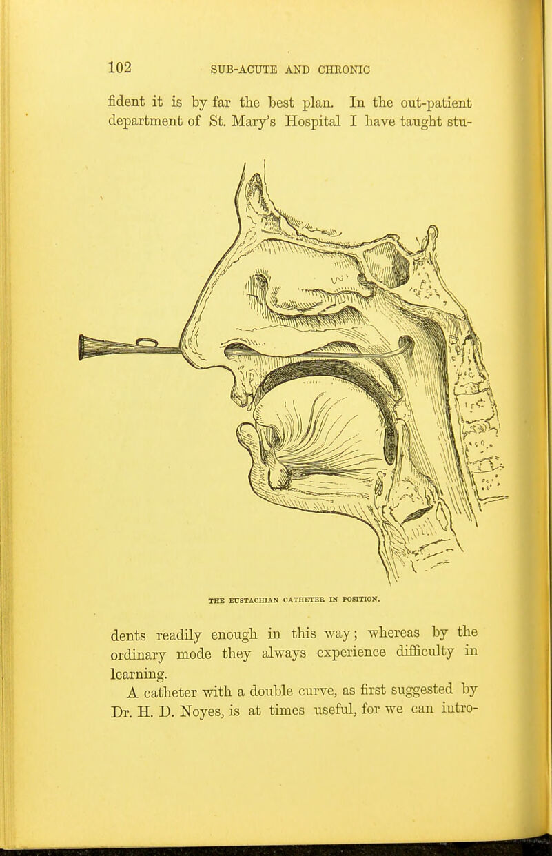 fident it is by far the best plan. In tbe out-patient department of St. Mary's Hospital I have taught stu- TBE BnSTACHIAN OATHETEB IN POSmON. dents readily enough in this way; whereas by the ordinary mode they always experience difficulty in learning. A catheter with a double curve, as first suggested by Dr. H. D. Noyes, is at times useful, for we can iutro-