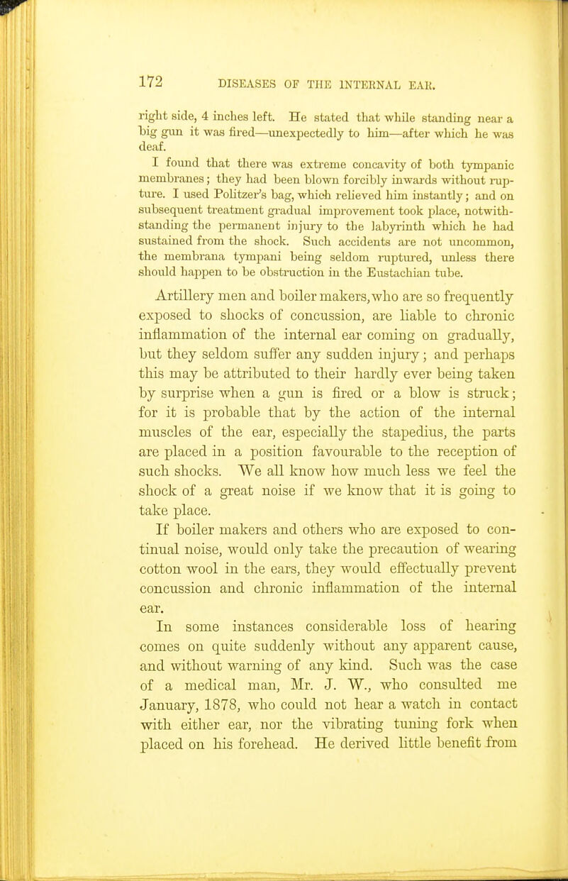 right side, 4 inches left. He stated that while standing near a big gun it was fired—unexpectedly to him—after which he was deaf. I fo\md that there was extreme concavity of both tympanic membranes; they had been blown forcibly inwards without rup- ture. I used Politzer's bag, which relieved him instantly; and on subsequent treatment gi-adual improvement took place, notwith- standing the permanent injury to the labyrinth which he had sustained from the shock. Such accidents are not uncommon, the membrana tympani being seldom ruptured, \mless there should happen to be obstruction in the Eiistachian tube. Artillery men and boiler makers, who are so frequently exposed to shocks of concussion, are liable to chronic inflammation of the internal ear coming on gradually, but they seldom suffer any sudden injury; and perhaps this may be attributed to their hardly ever being taken by surprise -when a gun is fired or a blow is struck; for it is probable that by the action of the internal muscles of the ear, especially the stapedius, the parts are placed in a position favourable to the reception of such shocks. We all know how much less we feel the shock of a gTeat noise if we know that it is going to take place. If boiler makers and others who are exposed to con- tinual noise, would only take the precaution of wearing cotton wool in the ears, they would effectually prevent concussion and chronic inflammation of the internal ear. In some instances considerable loss of hearing comes on quite suddenly without any apparent cause, and without warning of any kind. Such was the case of a medical man, Mr. J. W., who consulted me January, 1878, who could not hear a watch in contact with eitlier ear, nor the vibrating tuning fork when p)laced on his forehead. He derived little benefit from