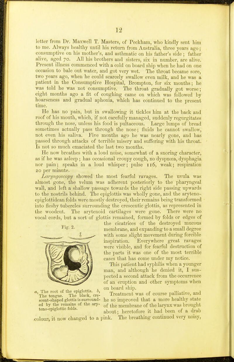 letter from Dr. Maxwell T. Masters, of Peckham, who kindly sent him to me. Always healthy until liis return from Australia, three years ago; consumi^tive on his mother's, and asthmatic on his father's side ; father alive, aged 70. All his brothers and sisters, six m number, are alive. Present ilhiess commenced with a cold on board ship when he had on one occasion to bale out water, and got very wet. The throat became sore, two years ago, when he could scarcely swallow even milk, and he was a patient in the Consumptive Hospital, Brompton, for six months; he was told he was not consumptive. Tlie throat gradually got worse; eight months ago a fit of coughing came on which was followed by hoarseness and gradual aphonia, which has continued to the present time. He has no pain, but in swallowing it tickles him at the back and roof of his mouth, which, if not carefully managed, suddenly regurgitates through the nose, imless his food is pultaceous. Large lumps of bread sometimes actually pass through the nose; fluids he cannot swallow, not even his saliva. Five months ago he was nearly gone, and has passed through attacks of terrible misery and suffering with his throat. Is not so much emaciated the last two months. He now breathes with a loud noise, somewhat of a snoring character, as if he was asleep ; has occasional croupy cough, no dyspncea, dysphagia nor pain; speaks in a loud whisper; pulse 116, weak; respiration 20 per minute. Laryngoscopy showed the most fearful ravages. Tlie uvula was almost gone, the velum was adherent posteriorly to the pharyngeal wall, and left a shallow passage towards the right side passing upwards to the nostrils behind. The epiglottis was wholly gone, and the aryteno- epiglottidean folds were mostly destroyed, their remains being trausfonned into fleshy tubercles surrounding the crescentic glottis, as represented in the woodcut. The arytenoid cartilages were gone. There were no vocal cords, but a sort of glottis remained, formed by folds or edges of the cicatrices of the destroyed mucous membrane, and expanding to a small degree with some slight movement dm-ing forcible inspiration. Everywhere great ravages were visible, and for fearful destruction of the parts it was one of the most terrible cases that has come under my notice. This patient had syphilis when a yoimger man, and although he denied it, I sus- pected a second attack from the occurrence of an eruption and other symptoms when on board sliip. Treatment was of course palhative, and he so improved that a more healthy state of the membrane of the larynx was brought about; heretofore it had been of a drab colom\ it now changed to a piiilv. The breathing contmued very noisy, Fis. 2. a, The root of the epiglottis, b, The tongue. The black, cre- scent-shaped glottis is surround- ed by the remains of the ary- teno-epiglottic folds.