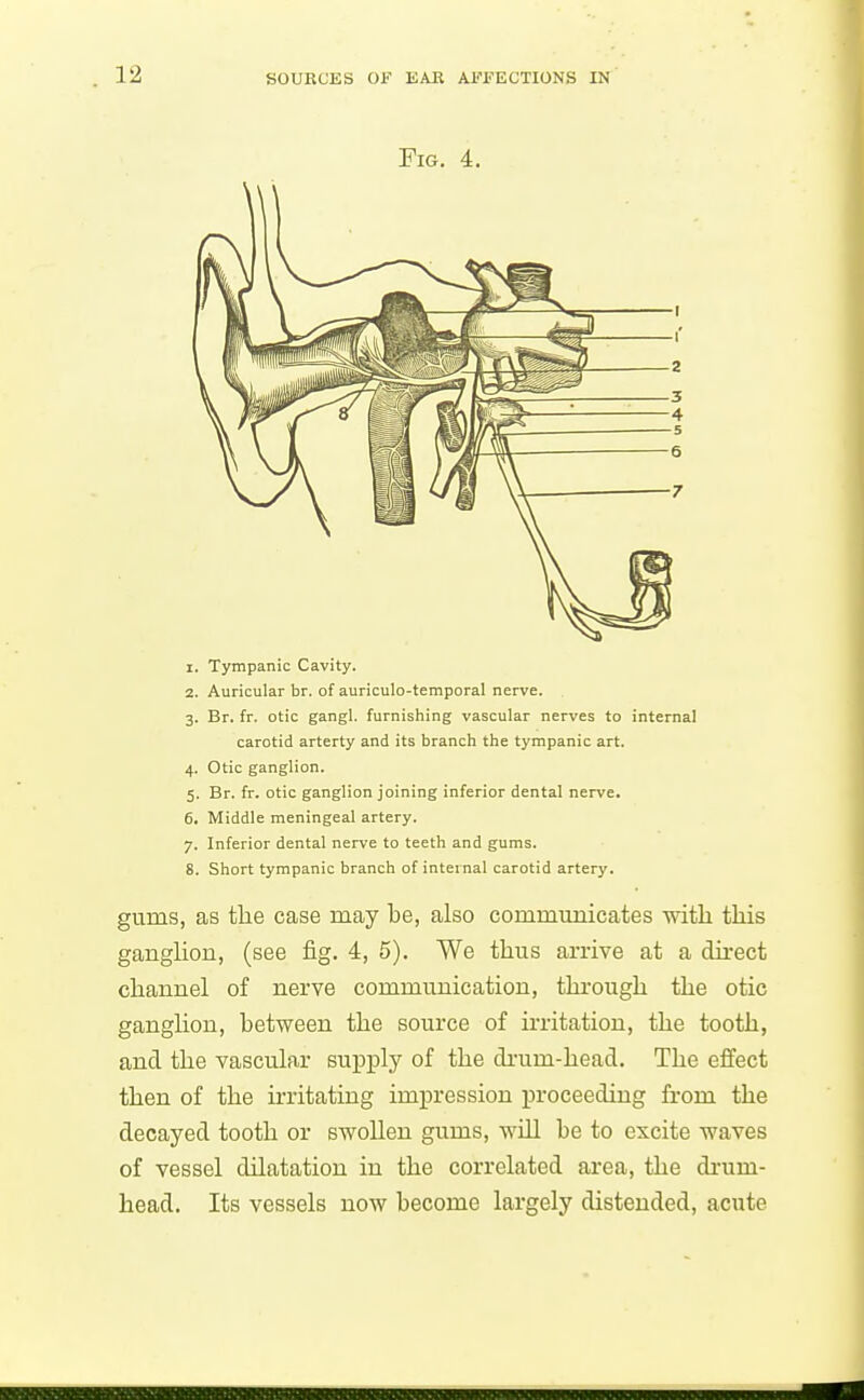 Fig. 4. 1. Tympanic Cavity. 2. Auricular br. of auriculo-temporal nerve. 3. Br. fr. otic gangl. furnishing vascular nerves to internal carotid arterty and its branch the tympanic art. 4. Otic ganglion. 5. Br. fr. otic ganglion joining inferior dental nerve. 6. Middle meningeal artery. 7. Inferior dental nerve to teeth and gums. 8. Short tympanic branch of internal carotid artery. gums, as tlie case may be, also commmiicates with this ganglion, (see fig. 4, 5). We thus arrive at a direct channel of nerve communication, through the otic ganglion, between the source of irritation, the tooth, and the vascular supply of the di-um-head. The effect then of the irritating impression proceeding from the decayed tooth or swollen gums, will be to excite waves of vessel dilatation in the correlated area, the drum- head. Its vessels now become largely distended, acute