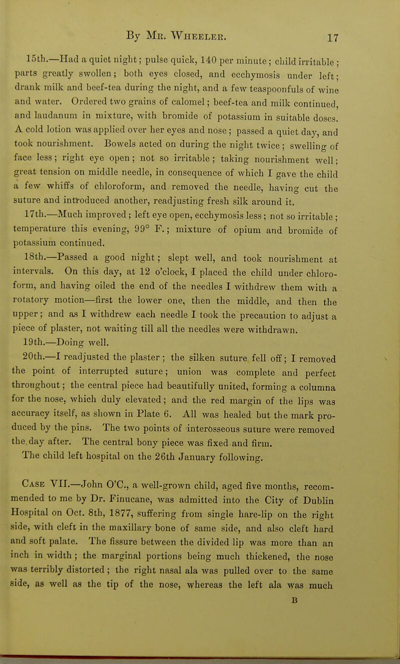 15th.—Had a quiet night; pulse quick, 140 per minute; child irritable ; parts greatly swollen; both eyes closed, and ecchymosis under left; drank milk and beef-tea during the night, and a few teaspoonfuls of wine and water. Ordered two grains of calomel; beef-tea and milk continued, and laudanum in mixture, with bromide of potassium in suitable doses. A cold lotion was applied over her eyes and nose; passed a quiet day, and took nourishment. Bowels acted on during the night twice ; swelling of face less; right eye open; not so irritable ; taking nourishment well; great tension on middle needle, in consequence of Avhich I gave the child a few whiffs of chloroform, and removed the needle, having cut the suture and inti'oduced another, readjusting fresh silk around it. 17th.—^aiuch improved; left eye open, ecchymosis less ; not so irritable ; temperature this evening, 99° F.; mixture of opium and bromide of potassium continued. 18th.—Passed a good night; slept well, and took nourishment at intervals. On this day, at 12 o'clock, I placed the child under chloro- form, and having oiled the end of the needles I withdrew them with a rotatory motion—first the lower one, then the middle, and then the upper; and as I withdrew each needle I took the precaution to adjust a piece of plaster, not waiting till all the needles were withdrawn. 19th.—Doing well. 20th.—I readjusted the plaster ; the silken suture fell off; I removed the point of interrupted suture; union was complete and perfect throughout; the central piece had beautifully united, forming a columna for the nose, which duly elevated; and the red margin of the lips was accuracy itself, as shown in Plate 6. All was healed but the mark pro- duced by the pins. The two points of interosseous suture were removed the. day after. The central bony piece was fixed and firm. The child left hospital on the 26th January following. Case VII.—John O'C, a well-grown child, aged five months, recom- mended to me by Dr. Finucane, was admitted into the City of Dublin Hospital on Oct. 8th, 1877, suffering from single hare-lip on the right side, with cleft in the maxillary bone of same side, and also cleft hard and soft palate. The fissure between the divided lip was more than an inch in width ; the marginal portions being much thickened, the nose was terribly distorted ; the right nasal ala was pulled over to the same side, as well as the tip of the nose, whereas the left ala was much B