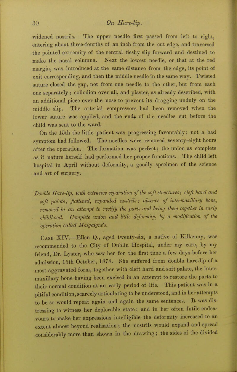 widened nostrils. The upper needle first passed from left to right, entering about three-fourths of an inch from the cut edge, and traversed the pointed extremity of the central fleshy slip forward and destined to make the nasal columna. Next the lowest needle, or that at the red margin, was introduced at the same distance from the edge, its point of exit corresponding, and then the middle needle in the same way. Twisted suture closed the gap, not from one needle to the other, but from each one separately; collodion over all, and plaster, as already described, with an additional piece over the nose to prevent its dragging unduly on the middle slip. The arterial compressors had been removed when the lower suture was applied, and the enda of tlie needles cut before the child was sent to the ward. On the 15th the little patient was progressing favourably; not a bad symptom had followed. The needles were removed seventy-eight hours after the operation. The formation was perfect; the union as complete as if nature herself had performed her proper functions. The child left hospital in April without deformity, a goodly specimen of the science and art of surgery. Double Hare-lip, with extensive separation of the soft structures; cleft hard and soft palate; fattened, expanded nostrils; absence of intermaxillary hone, removed in an attempt to rectify the parts and bring them together in early ■ childhood. Complete union and little deformity, by a modification of the operation called Malgaigne's. Case XIV.—Ellen Q., aged twenty-six, a native of Kilkenny, was recommended to the City of Dublin Hospital, under my care, by my friend, Dr. Lyster, who saw her for the first time a few days before her admission, 15th October, 1878. She suffered from double hare-lip of a most aggravated form, together with cleft hard and soft palate, the inter- maxillary bone having been excised in an attempt to restore the parts to their normal condition at an early period of life. This patient was in a pitiful condition, scarcely articulating to be understood, and in her attempts to be so would repeat again and again the same sentences. It was dis- tressing to witness her deplorable state; and in her often futile endea- vours to make her expressions intelligible the deformity increased to an extent almost beyond realisation ; the nostrils would expand and spread considerably more than shown in the drawing ; the sides of the divided