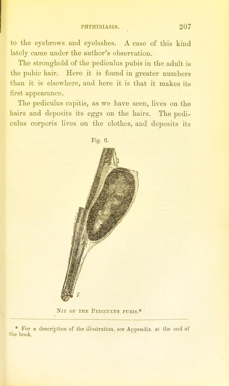 to the eyebrows and eyelashes. A case of this kind lately came under the author's observation. The stronghold of the pediculus pubis in the adult is the pubic hair. Here it is found in greater numbers than it is elsewhere, and here it is that it makes its first appearance. The pediculus capitis, as we have seen, lives on the hairs and deposits its eggs on the hairs. The pedi- culus corporis lives on the clothes, and deposits its Fig. G. Nit op the Pedictjltts pubis.* * For a description of the illustration, see Appendix at the end of