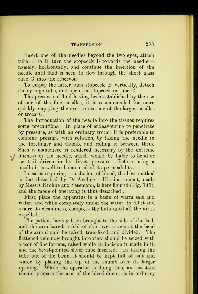 Insert one of the needles beyond the two eyes, attach tube F to it, turn the stopcock B towards the needle— namely, horizontally, and continue the insertion of the needle until fluid is seen to flow through the short glass tube G into the reservoir. To empty the latter turn stopcock B vertically, detach the syringe tube, and open the stopcock in tube C. The presence of fluid having been established by the use of one of the fine needles, it is recommended for more quickly emptying the cyst to use one of the larger needles or trocars. The introduction of the needle into the tissues requires some precautions. In place of endeavouring to penetrate by pressure, as with an ordinary trocar, it is preferable to combine pressure with rotation, by taking the needle in the forefinger and thumb, and rolling it between them. Such a manoeuvre is rendered necessary by the extreme fineness of the needle, which would be liable to bend or twist if driven in by direct pressure. Before using a needle it is well to be assured of its permeability. In cases requiring transfusion of blood, the best method is that described by Dr Aveling. His instrument, made by Messrs Krohne and Sesemann, is here figured (Fig. 145), and the mode of operating is thus described : First, place the apparatus in a basin of warm salt and water, and while completely under the water, to fill it and insure its cleanliness, compress the bulb until all the air is expelled. The patient having been brought to the side of the bed, and the arm bared, a fold of skin over a vein at the bend of the arm should be raised, transfixed, and divided. The flattened vein now brought into view should be seized with a pair of fine forceps, raised while an incision is made in it, and the bevel-pointed silver tube inserted. In taking the tube out of the basin, it should be kept full of salt and water by placing the tip of the thumb over its larger opening. While the operator is doing this, an assistant should prepare the arm of the blood donor, as in ordinary
