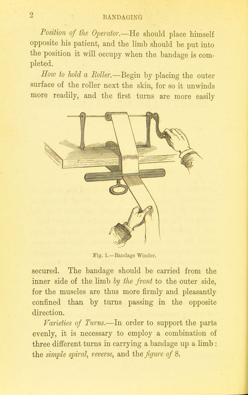 Position of the Operator.—He should place himself opposite his patient, and the limb should be put into the position it will occupy when the bandage is com- pleted. How to hold a Roller.—Begin by placing the outer surface of the roller next the skin, for so it unwinds more readily, and the first turns are more easily Eig. 1.—Bandage Winder. secured. The bandage should be carried from the inner side of the limb by the front to the outer side, for the muscles are thus more firmly and pleasantly confined than by turns passing in the opposite direction. Varieties of Turns.—In order to support the parts evenly, it is necessary to employ a combination of three different turns in carrying a bandage up a limb : the simple spiral, reverse, and the figure of S.