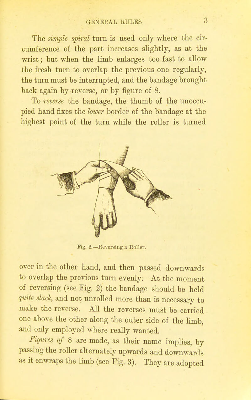 GENERAL RULES The simple spiral turn is used only where the cir- cumference of the part increases slightly, as at the wrist; but when the limb enlarges too fast to allow the fresh turn to overlap the previous one regularly, the turn must be interrupted, and the bandage brought back again by reverse, or by figure of 8. To reverse the bandage, the thumb of the unoccu- pied hand fixes the lower border of the bandage at the highest point of the turn while the roller is turned Pig. 2.—Reversing a Roller. over in the other hand, and then passed downwards to overlap the previous turn evenly. At the moment of reversing (see Fig. 2) the bandage should be held quite slack, and not unrolled more than is necessary to make the reverse. All the reverses must be carried one above the other along the outer side of the limb, and only employed where really wanted. Figures of 8 are made, as their name implies, by passing the roller alternately upwards and downwards as it enwraps the limb (see Fig. 3). They are adopted