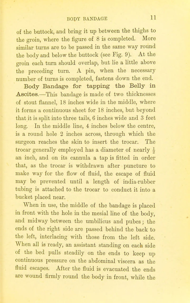 BODY BANDAGE of the buttock, and bring it up between the thighs to the groin, where the figure of 8 is completed. More similar turns are to be passed in the same way round the body and below the buttock (see Fig. 9). At the groin each turn should overlap, but lie a little above the preceding turn. A pin, when the necessary number of turns is completed, fastens down the end. Body Bandage for tapping the Belly in Ascites.—This bandage is made of two thicknesses of stout flannel, 18 inches wide in the middle, where it forms a continuous sheet for 18 inches, but beyond that it is split into three tails, 6 inches wide and 3 feet long. In the middle line, 4 inches below the centre, is a round hole 2 inches across, through which the surgeon reaches the skin to insert the trocar. The trocar generally employed has a diameter of nearly \ an inch, and on its cannula a tap is fitted in order that, as the trocar is withdrawn after puncture to make way for the flow of fluid, the escape of fluid may be prevented until a length of india-rubber tubing is attached to the trocar to conduct it into a bucket placed near. When in use, the middle of the bandage is placed in front with the hole in the mesial line of the body, and midway between the umbilicus and pubes; the ends of the right side are passed behind the back to the left, interlacing with those from the left side. When all is ready, an assistant standing on each side of the bed pulls steadily on the ends to keep up continuous pressure on the abdominal viscera as the fluid escapes. After the fluid is evacuated the ends are wound firmly round the body in front, while the