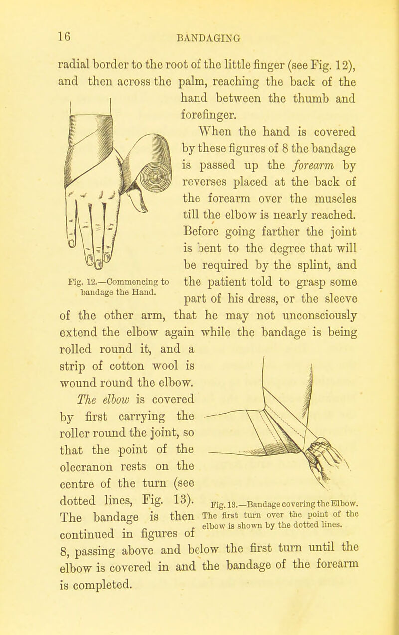 Fig. 12.—Commencing to bandage the Hand. radial border to the root of the little finger (see Fig. 12), and then across the palm, reaching the back of the hand between the thumb and forefinger. When the hand is covered by these figures of 8 the bandage is passed up the forearm by reverses placed at the back of the forearm over the muscles till the elbow is nearly reached. Before going farther the joint is bent to the degree that will be required by the splint, and the patient told to grasp some part of his dress, or the sleeve of the other arm, that he may not unconsciously extend the elbow again while the bandage is being rolled round it, and a strip of cotton wool is wound round the elbow. The elbow is covered by first carrying the roller round the joint, so that the point of the olecranon rests on the centre of the turn (see dotted lines, Fig. 13). The bandage is then continued in figures of 8, passing above and below the first turn until the elbow is covered in and the bandage of the forearm is completed. Fig. 13.—Bandage covering the Elbow. The first turn over the point of the elbow is shown by the dotted lines.