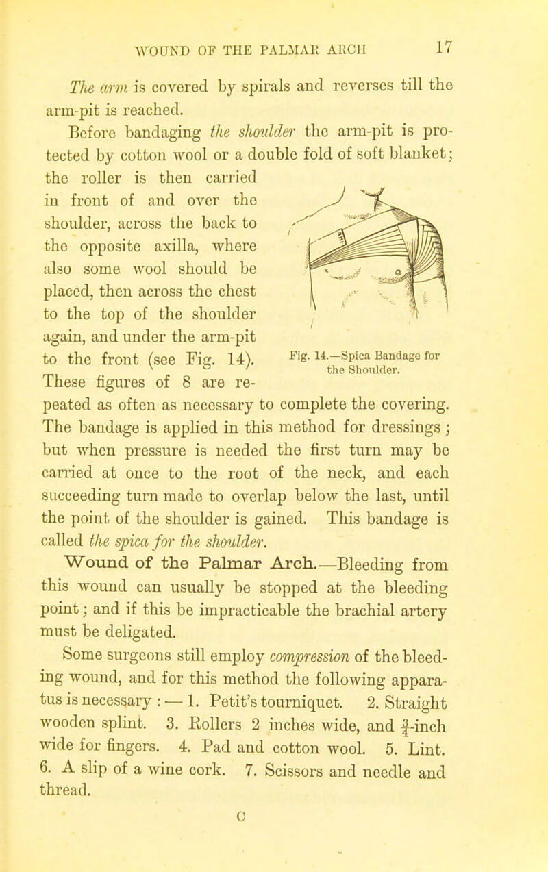 WOUND OF THE PALMAR ARCH The arm is covered by spirals and reverses till the arm-pit is reached. Before bandaging the shoulder the arm-pit is pro- tected by cotton wool or a double fold of soft blanket; the roller is then carried in front of and over the shoulder, across the back to the opposite axilla, where also some wool should be placed, then across the chest to the top of the shoulder again, and under the arm-pit to the front (see Fie. 14). Fig. 14.-Spica Bandage for v & ' the Shoulder. These figures of 8 are re- peated as often as necessary to complete the covering. The bandage is applied in this method for dressings ; but when pressure is needed the first turn may be carried at once to the root of the neck, and each succeeding turn made to overlap below the last, until the point of the shoulder is gained. This bandage is called the spica for the shoulder. Wound of the Palmar Arch.—Bleeding from this wound can usually be stopped at the bleeding point; and if this be impracticable the brachial artery must be deligated. Some surgeons still employ compression of the bleed- ing wound, and for this method the following appara- tus is necessary : — 1. Petit's tourniquet. 2. Straight wooden splint. 3. Rollers 2 inches wide, and f-inch wide for fingers. 4. Pad and cotton wool. 5. Lint. 6. A slip of a wine cork. 7. Scissors and needle and thread. c