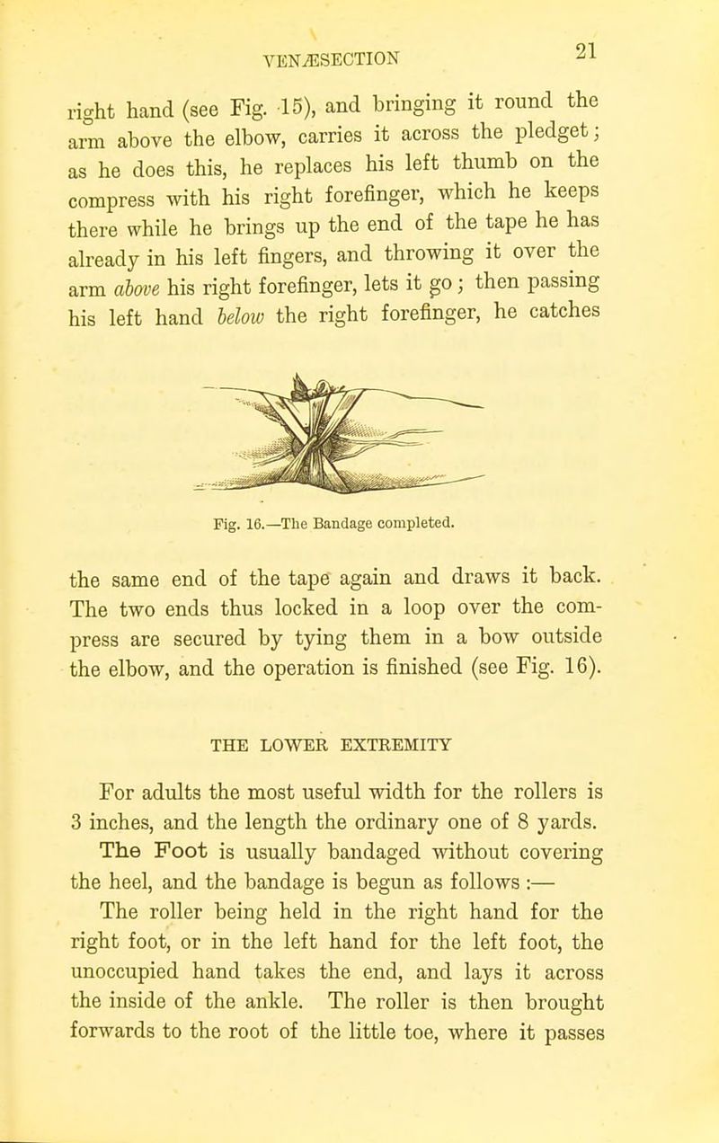 right hand (see Fig. 15), and bringing it round the arm above the elbow, carries it across the pledget; as he does this, he replaces his left thumb on the compress with his right forefinger, which he keeps there while he brings up the end of the tape he has already in his left fingers, and throwing it over the arm above his right forefinger, lets it go; then passing his left hand below the right forefinger, he catches the same end of the tape again and draws it back. The two ends thus locked in a loop over the com- press are secured by tying them in a bow outside the elbow, and the operation is finished (see Fig. 16). For adults the most useful width for the rollers is 3 inches, and the length the ordinary one of 8 yards. The Foot is usually bandaged without covering the heel, and the bandage is begun as follows :— The roller being held in the right hand for the right foot, or in the left hand for the left foot, the unoccupied hand takes the end, and lays it across the inside of the ankle. The roller is then brought forwards to the root of the little toe, where it passes Fig. 16.—The Bandage completed. THE LOWER EXTREMITY