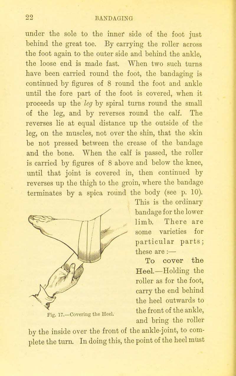 under the sole to the inner side of the foot just behind the great toe. By carrying the roller across the foot again to the outer side and behind the ankle, the loose end is made fast. When two such turns have been carried round the foot, the bandaging is continued by figures of 8 round the foot and ankle until the fore part of the foot is covered, when it proceeds up the leg by spiral turns round the small of the leg, and by reverses round the calf. The reverses lie at equal distance up the outside of the leg, on the muscles, not over the shin, that the skin be not pressed between the crease of the bandage and the bone. When the calf is passed, the roller is carried by figures of 8 above and below the knee, until that joint is covered in, then continued by reverses up the thigh to the groin, where the bandage terminates by a spica round the body (see p. 10). This is the ordinary bandage for the lower limb. There are some varieties for particular parts; these are:— To cover the Heel.—Holding the roller as for the foot, carry the end behind the heel outwards to the front of the ankle, and bring the roller by the inside over the front of the ankle-joint, to com- plete the turn. In doing this, the point of the heel must Fig. 17.—Covering the Heel.