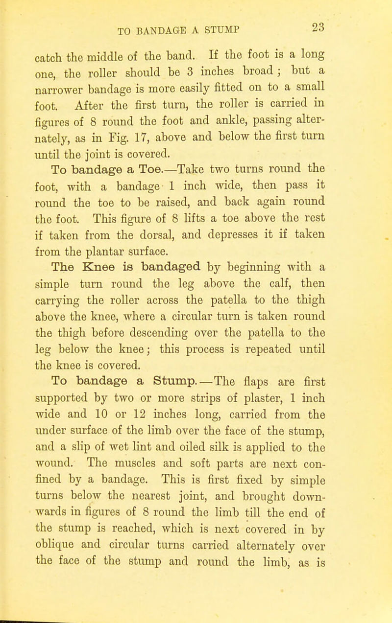 TO BANDAGE A STUMP catch the middle of the band. If the foot is a long one, the roller should be 3 inches broad; but a narrower bandage is more easily fitted on to a small foot. After the first turn, the roller is carried in figures of 8 round the foot and ankle, passing alter- nately, as in Fig. 17, above and below the first turn until the joint is covered. To bandage a Toe.—Take two turns round the foot, with a bandage 1 inch wide, then pass it round the toe to be raised, and back again round the foot. This figure of 8 lifts a toe above the rest if taken from the dorsal, and depresses it if taken from the plantar surface. The Knee is bandaged by beginning with a simple turn round the leg above the calf, then carrying the roller across the patella to the thigh above the knee, where a circular turn is taken round the thigh before descending over the patella to the leg below the knee; this process is repeated until the knee is covered. To bandage a Stump.—The flaps are first supported by two or more strips of plaster, 1 inch wide and 10 or 12 inches long, carried from the under surface of the limb over the face of the stump, and a slip of wet lint and oiled silk is applied to the wound. The muscles and soft parts are next con- fined by a bandage. This is first fixed by simple turns below the nearest joint, and brought down- wards in figures of 8 round the limb till the end of the stump is reached, which is next covered in by oblique and circular turns carried alternately over the face of the stump and round the limb, as is