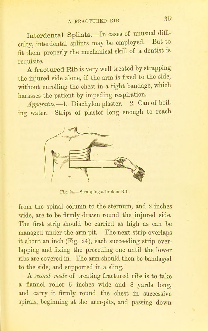 A FRACTURED RIB Interdental Splints.—In cases of unusual diffi- culty, interdental splints may be employed. But to fit them properly the mechanical skill of a dentist is requisite. A fractured Rib is very well treated by strapping the injured side alone, if the arm is fixed to the side, without enrolling the chest in a tight bandage, which harasses the patient by impeding respiration. Apparatus—1. Diachylon plaster. 2. Can of boil- ing water. Strips of plaster long enough to reach Fig. 24.—Strapping a broken Rib. from the spinal column to the sternum, and 2 inches wide, are to be firmly drawn round the injured side. The first strip should be carried as high as can be managed under the arm-pit. The next strip overlaps it about an inch (Fig. 24), each succeeding strip over- lapping and fixing the preceding one until the lower ribs are covered in. The arm should then be bandaged to the side, and supported in a sling. A second mode of treating fractured ribs is to take a flannel roller 6 inches wide and 8 yards long, and carry it firmly round the chest in successive spirals, beginning at the arm-pits, and passing down