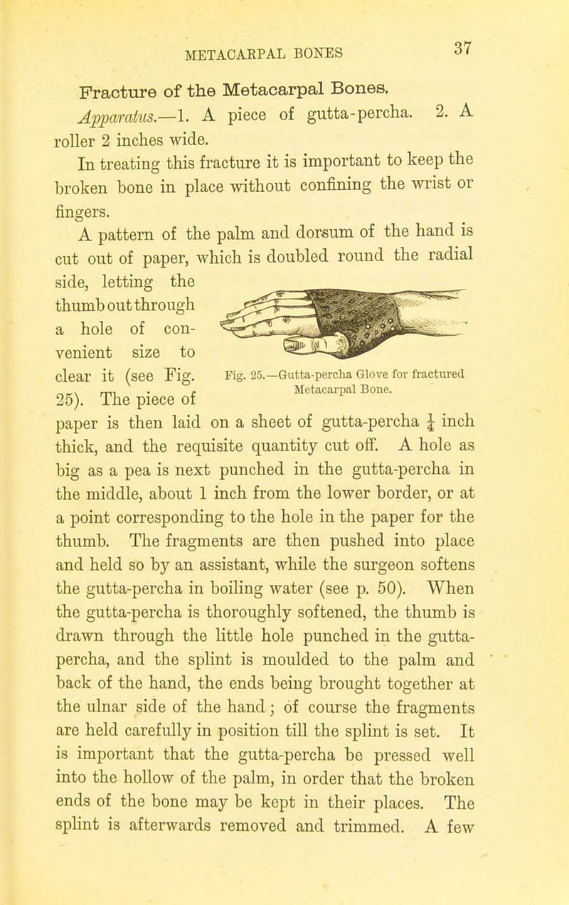 METACARPAL BONES Fracture of the Metacarpal Bones. Apparatus.—I. A piece of gutta-percha. 2. A roller 2 inches wide. In treating this fracture it is important to keep the broken bone in place without confining the wrist or fingers. A pattern of the palm and dorsum of the hand is cut out of paper, which is doubled round the radial side, letting the thumb out through a hole of con- venient size to clear it (see Fig. Fig. 25.—Gutta-percha Glove for fractured „„. . . Metacarpal Bone. 25). The piece of paper is then laid on a sheet of gutta-percha \ inch thick, and the requisite quantity cut off. A hole as big as a pea is next punched in the gutta-percha in the middle, about 1 inch from the lower border, or at a point corresponding to the hole in the paper for the thumb. The fragments are then pushed into place and held so by an assistant, while the surgeon softens the gutta-percha in boiling water (see p. 50). When the gutta-percha is thoroughly softened, the thumb is drawn through the little hole punched in the gutta- percha, and the splint is moulded to the palm and back of the hand, the ends being brought together at the ulnar side of the hand; of course the fragments are held carefully in position till the splint is set. It is important that the gutta-percha be pressed well into the hollow of the palm, in order that the broken ends of the bone may be kept in their places. The splint is afterwards removed and trimmed. A few