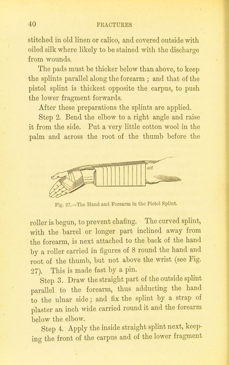 stitched in old linen or calico, and covered outside with oiled silk where likely to be stained with the discharge from wounds. The pads must be thicker below than above, to keep the splints parallel along the forearm ; and that of the pistol splint is thickest opposite the carpus, to push the lower fragment forwards. After these preparations the splints are applied. Step 2. Bend the elbow to a right angle and raise it from the side. Put a very little cotton wool in the palm and across the root of the thumb before the Fig. 27.— The Hand and Forearm in the Pistol Splint. roller is begun, to prevent chafing. The curved splint, with the barrel or longer part inclined away from the forearm, is next attached to the back of the hand by a roller carried in figures of 8 round the hand and root of the thumb, but not above the wrist (see Fig. 27). This is made fast by a pin. Step 3. Draw the straight part of the outside splint parallel to the forearm, thus adducting the hand to the ulnar side; and fix the splint by a strap of plaster an inch wide carried round it and the forearm below the elbow. Step 4. Apply the inside straight splint next, keep- ing the front of the carpus and of the lower fragment
