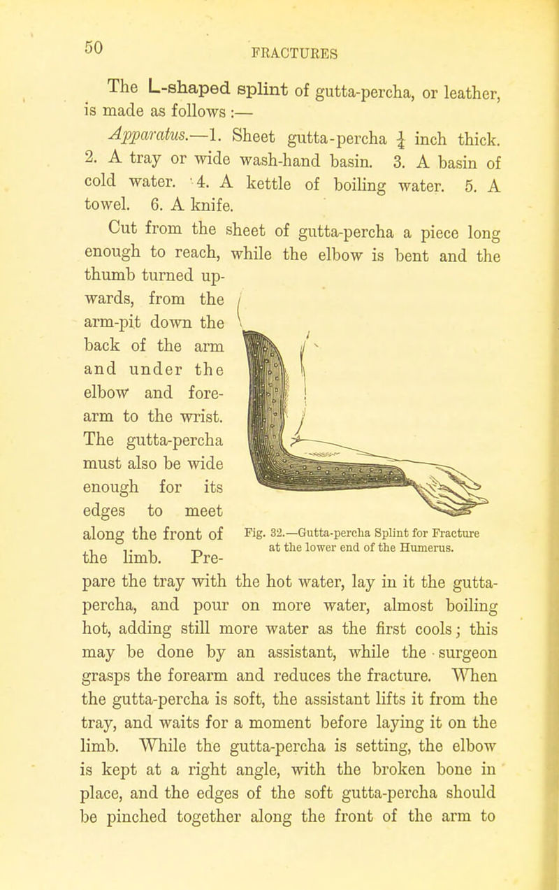 The L-shaped splint of gutta-percha, or leather, is made as follows :— Apparatus.—I. Sheet gutta-percha { inch thick. 2. A tray or wide wash-hand basin. 3. A basin of cold water. -4. A kettle of boiling water. 5. A towel. 6. A knife. Cut from the sheet of gutta-percha a piece long enough to reach, while the elbow is bent and the thumb turned up- wards, from the / pare the tray with the hot water, lay in it the gutta- percha, and pour on more water, almost boiling hot, adding still more water as the first cools; this may be done by an assistant, while the surgeon grasps the forearm and reduces the fracture. When the gutta-percha is soft, the assistant lifts it from the tray, and waits for a moment before laying it on the limb. While the gutta-percha is setting, the elbow is kept at a right angle, with the broken bone in place, and the edges of the soft gutta-percha should be pinched together along the front of the arm to back of the arm and under the elbow and fore- arm to the wrist. The gutta-percha must also be wide enough for its edges to meet along the front of the limb. Pre- Fig. 32.—Outta-perclia Splint for Fracture at the lower end of the Humerus.