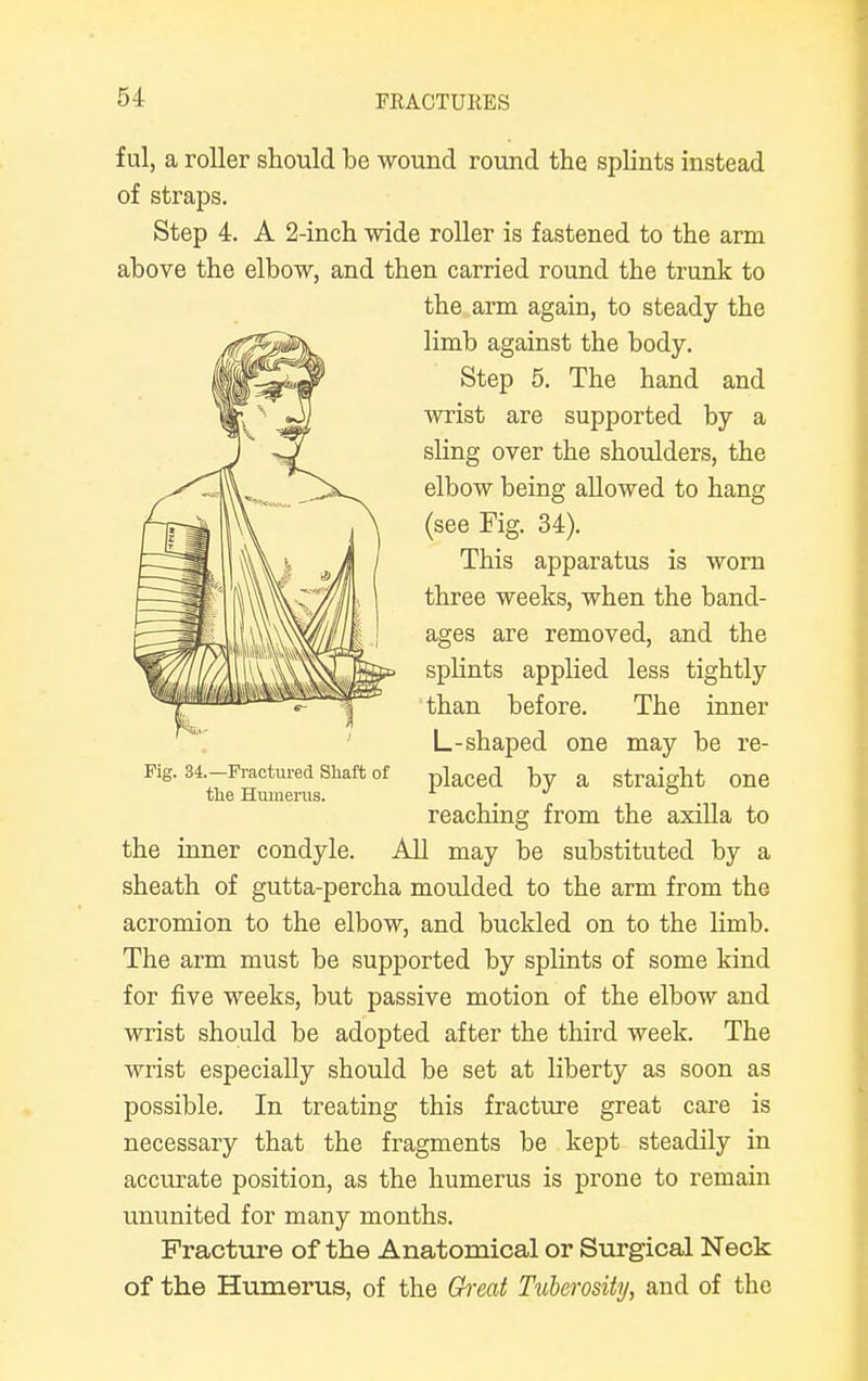f ul, a roller should be wound round the splints instead of straps. Step 4. A 2-inch wide roller is fastened to the arm above the elbow, and then carried round the trunk to the arm again, to steady the limb against the body. Step 5. The hand and wrist are supported by a sling over the shoulders, the elbow being allowed to hang (see Fig. 34). This apparatus is worn three weeks, when the band- ages are removed, and the splints applied less tightly than before. The inner L-shaped one may be re- Fig. 34.-Fractured shaft of placed by a straight one the Humerus. . . reaching from the axilla to the inner condyle. All may be substituted by a sheath of gutta-percha moulded to the arm from the acromion to the elbow, and buckled on to the limb. The arm must be supported by splints of some kind for five weeks, but passive motion of the elbow and wrist should be adopted after the third week. The wrist especially should be set at liberty as soon as possible. In treating this fracture great care is necessary that the fragments be kept steadily in accurate position, as the humerus is prone to remain ununited for many months. Fracture of the Anatomical or Surgical Neck of the Humerus, of the Great Tuberosity, and of the