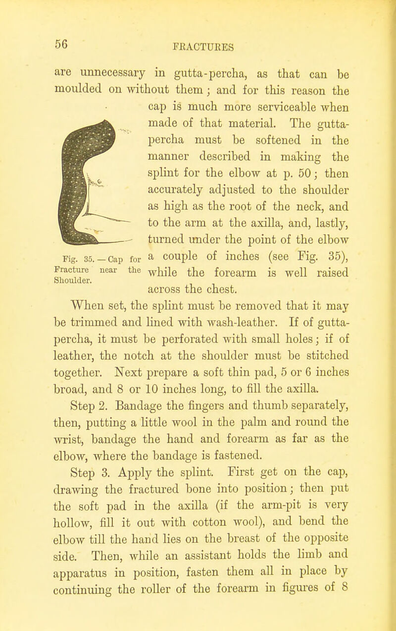 are unnecessary in gutta-percha, as that can be moulded on without them j and for this reason the cap is much more serviceable when made of that material. The gutta- percha must be softeued in the manner described in making the splint for the elbow at p. 50; then accurately adjusted to the shoulder as high as the root of the neck, and to the arm at the axilla, and, lastly, turned under the point of the elbow Fig. 35.-cap for a couple of inches (see Fig. 35), Fracture near the whjie the forearm is well raised Shoulder. across the chest. When set, the splint must be removed that it may be trimmed and lined with wash-leather. If of gutta- percha, it must be perforated with small holes; if of leather, the notch at the shoulder must be stitched together. Next prepare a soft thin pad, 5 or 6 inches broad, and 8 or 10 inches long, to fill the axilla. Step 2. Bandage the fingers and thumb separately, then, putting a little wool in the palm and round the wrist, bandage the hand and forearm as far as the elbow, where the bandage is fastened. Step 3. Apply the splint. First get on the cap, drawing the fractured bone into position; then put the soft pad in the axilla (if the arm-pit is very hollow, fill it out with cotton wool), and bend the elbow till the hand lies on the breast of the opposite side. Then, while an assistant holds the limb and apparatus in position, fasten them all in place by continuing the roller of the forearm in figures of 8