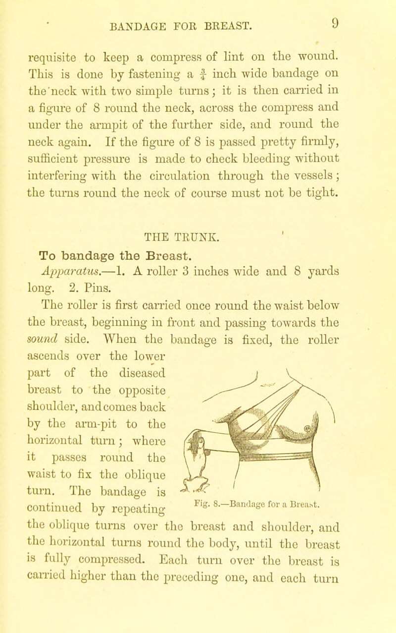 BANDAGE FOR BREAST. requisite to keep a compress of lint on the wound. This is clone by fastening a f inch wide bandage on the neck with two simple turns; it is then carried in a figure of 8 round the neck, across the compress and under the armpit of the further side, and round the neck again. If the figure of 8 is passed pretty firmly, sufficient pressm'e is made to check bleeding without interfering with the circulation through the vessels; the turns round the neck of course must not be tight. THE TRUNK. To bandage the Breast. Apparatus.—1. A roller 3 inches wide and 8 yards long. 2. Pins. The roller is first carried once round the waist below the breast, beginning in front and passing towards the sound side. When the bandage is fixed, the roller ascends over the lower part of the diseased breast to the opposite shoulder, and comes back by the arm-pit to the horizontal turn; where it passes round the waist to fix the oblique turn. The bandage is continued by repeating the oblique turns over the breast and shoulder, and the horizontal turns round the body, until the breast is fully compressed. Each turn over the breast is carried higher than the preceding one, and each turn