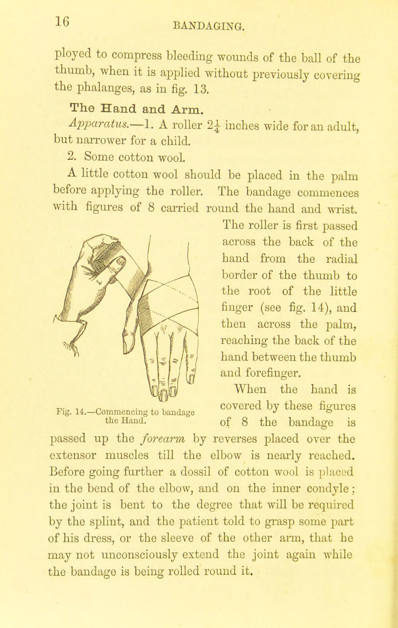 ployed to compress bleeding wounds of the ball of the thumb, when it is applied without previously covering the phalanges, as in fig. 13. The Hand and Arm. Apparatus.—!. A roller 2£ inches wide for an adult, but narrower for a child. 2. Some cotton wooL A little cotton wool should be placed in the palm before applying the roller. The bandage commences with figures of 8 carried round the hand and wrist. passed up the forearm by reverses placed over the extensor muscles till the elbow is nearly reached. Before going further a dossil of cotton wool is placed in the bend of the elbow, and on the inner condyle : the joint is bent to the degree that will be required by the splint, and the patient told to grasp some part of his dress, or the sleeve of the other arm, that he may not unconsciously extend the joint again while the bandage is being rolled round it. The roller is first passed across the back of the hand from the radial border of the thumb to the root of the little finger (see fig. 14), and then across the palm, reaching the back of the hand between the thumb and forefinger. Fig. 14.—Commencing to bandage the Hand. When the hand is covered by these figures of 8 the bandage is