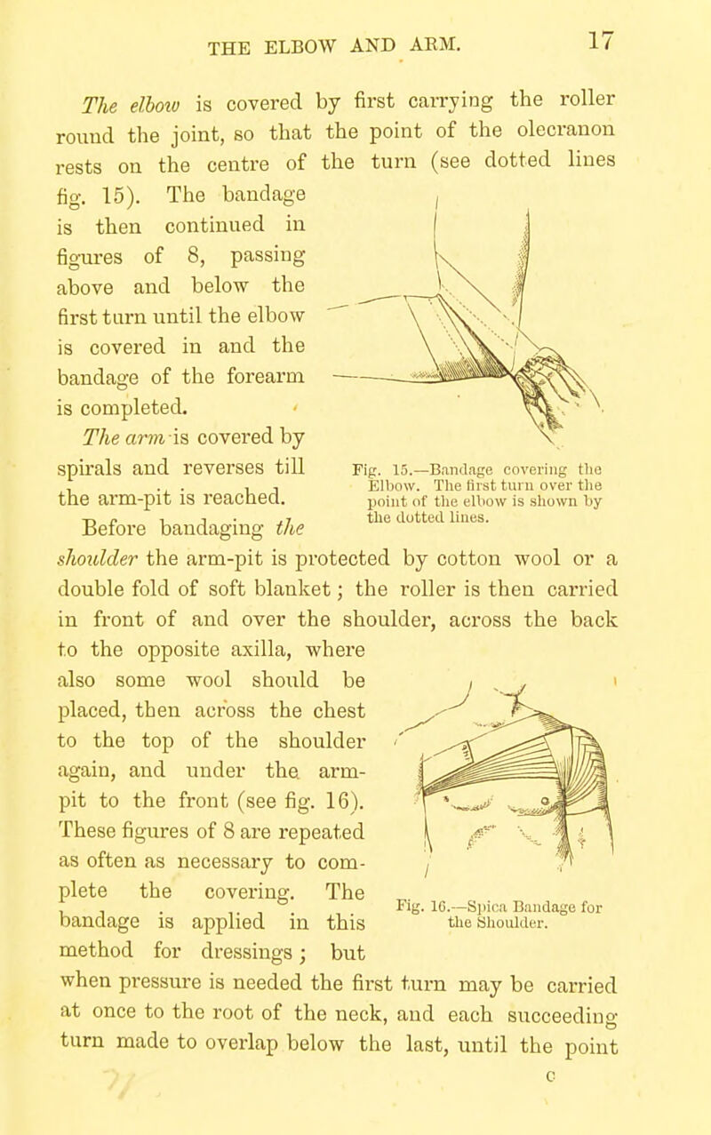 THE ELBOW AND ARM. Fig. 15.—Bandage covering the Elbow. The tirst turn over the point of the elbow is shown by the dotted lines. The elbow is covered by first carrying the roller round the joint, so that the point of the olecranon rests on the centre of the turn (see dotted lines fig. 15). The bandage is then continued in figures of 8, passing above and below the first tarn until the elbow- is covered in and the bandage of the forearm is completed. The arm is covered by spirals and reverses till the arm-pit is reached. Before bandaging the shoulder the arm-pit is protected by cotton wool or a double fold of soft blanket; the roller is then carried in front of and over the shoulder, across the back to the opposite axilla, where also some wool should be placed, then across the chest to the top of the shoulder again, and under the arm- pit to the front (see fig. 16). These figures of 8 are repeated as often as necessary to com- plete the covering. The bandage is applied in this method for dressings; but when pressure is needed the first turn may be carried at once to the root of the neck, and each succeeding turn made to overlap below the last, until the point Fig. 16.—Spiral Bandage for the Shoulder.