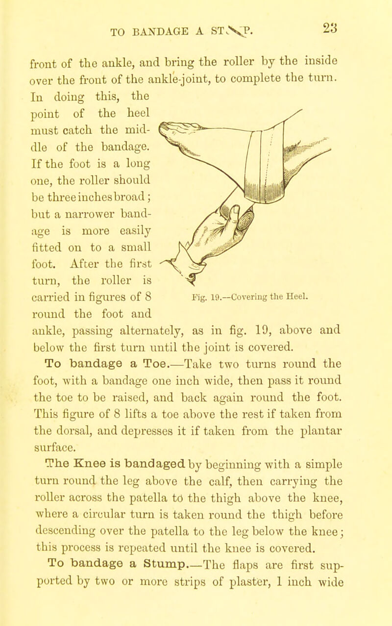 TO BANDAGE A ST,XP- front of the ankle, and bring the roller by the inside over the front of the ankle-joint, to complete the turn. In doing this, the point of the heel must catch the mid- dle of the bandage. If the foot is a long one, the roller should be threeinchesbroad; but a narrower band- age is more easily fitted on to a small foot. After the first turn, the roller is carried in figures of 8 Fig. 19.—Covering the Heel. round the foot and ankle, passing alternately, as in fig. 19, above and below the first turn until the joint is covered. To bandage a Toe.—Take two turns round the foot, with a bandage one inch wide, then pass it round the toe to be raised, and back again round the foot. This figure of 8 lifts a toe above the rest if taken from the dorsal, and depresses it if taken from the plantar surface. The Knee is bandaged, by beginning with a simple turn round the leg above the calf, then carrying the roller across the patella to the thigh above the knee, where a circular turn is taken round the thigh before descending over the patella to the leg below the knee; this process is repeated until the knee is covered. To bandage a Stump—The flaps are first sup- ported by two or more strips of plaster, 1 inch wide