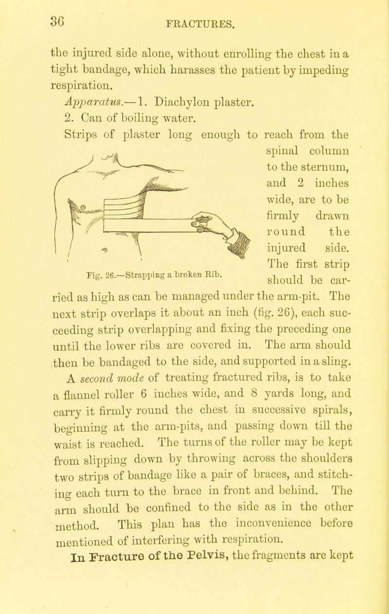 3G the injured side alone, without enrolling the chest in a tight bandage, which harasses the patient by impeding respiration. Apparatus.— 1. Diachylon plaster. 2. Can of boiling water. Strips of plaster long enough to reach from the spinal column to the sternum, and 2 inches wide, are to be firmly drawn round the injured side. The first strip Fig. 26.-Strarpiag a broken Rib. ^ ^ ried as high as can be managed under the arm-pit. The next strip overlaps it about an inch (fig. 26), each suc- ceeding strip overlapping and fixing the preceding one until the lower ribs are covered in. The arm should then be bandaged to the side, and supported in a sling. A second mode of treating fractured ribs, is to take a flannel roller 6 inches wide, and 8 yards long, and carry it firmly round the chest in successive spirals, beginning at the arm-pits, and passing down till the waist is reached. The turns of the roller may be kept fi-om slipping down by throwing across the shoulders two strips of bandage like a pair of braces, and stitch- in- each turn to the brace in front and behind. The arm should be confined to the side as in the other method. This plan has the inconvenience before mentioned of interfering with respiration. In Fracture of the Pelvis, the fragments are kept