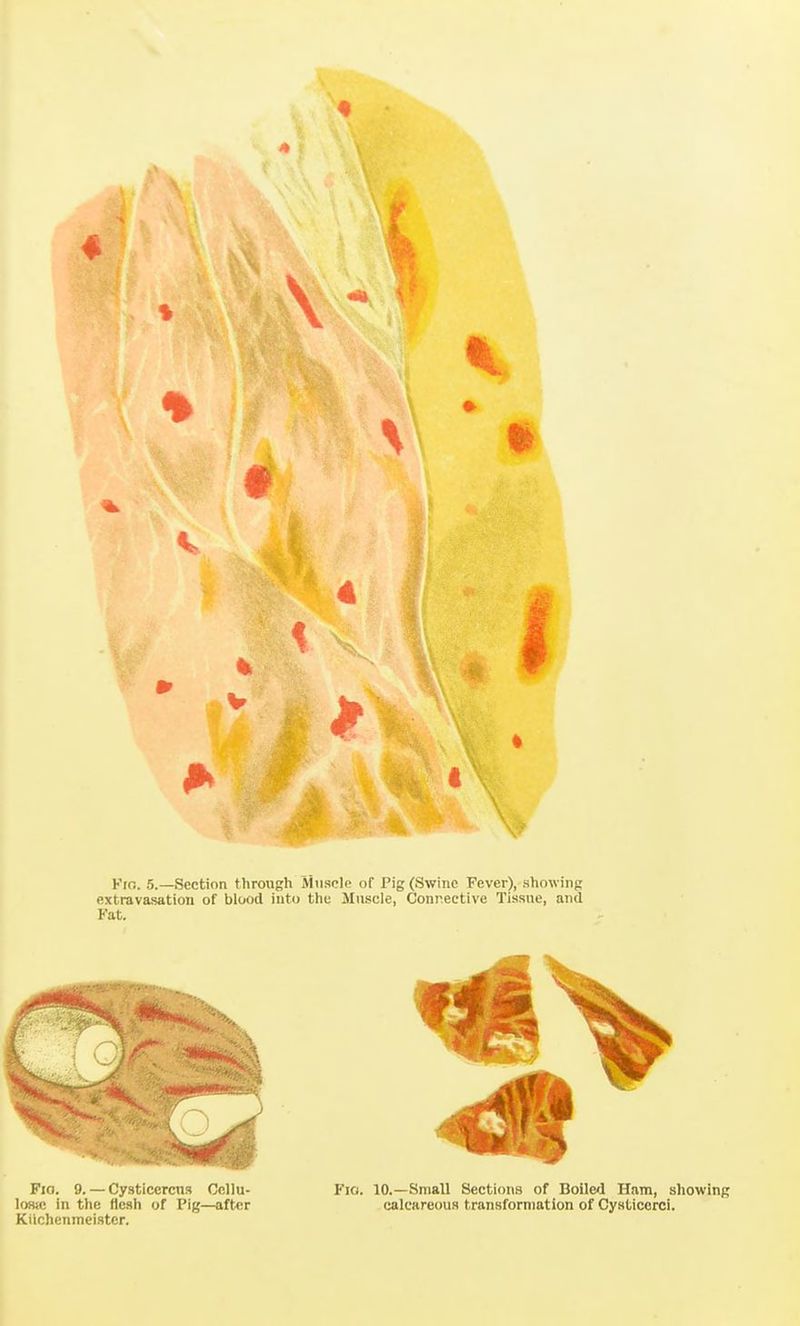 Fin. 5.—Section through Miisplc of Pig (Swine Fever), showing extravasation of blood into the Muscle, Connective Tissue, and Fat. Fio. 9. — Cysticercns Ccllu- losio in the flesh of Pig—after Kiichenmeistcr. Fio. 10.—Small Sections of Boilcl Ham, showing calcareous transformation of Cysticorci.