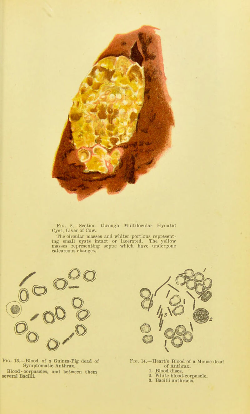 Fio. S.—Section through Multilocular Hydatid Cyst, Liver of Cow. The circular masses and whiter portions represent- iiig small cysts intact or lacerated. The yellow masses representing septw which have undergone calcareous changes. Fio. 13.—Bloofl of a Guinea-Pig dead of Symptomatic Anthrax. Blood - corpuscles, and between them several Bacilli. Km. 14.—Heart's Blood of a Mouse dead of Anthrax. 1. Blood discs. 2. Wliite blood-corpuscle. 8. Bacilli anthracis.