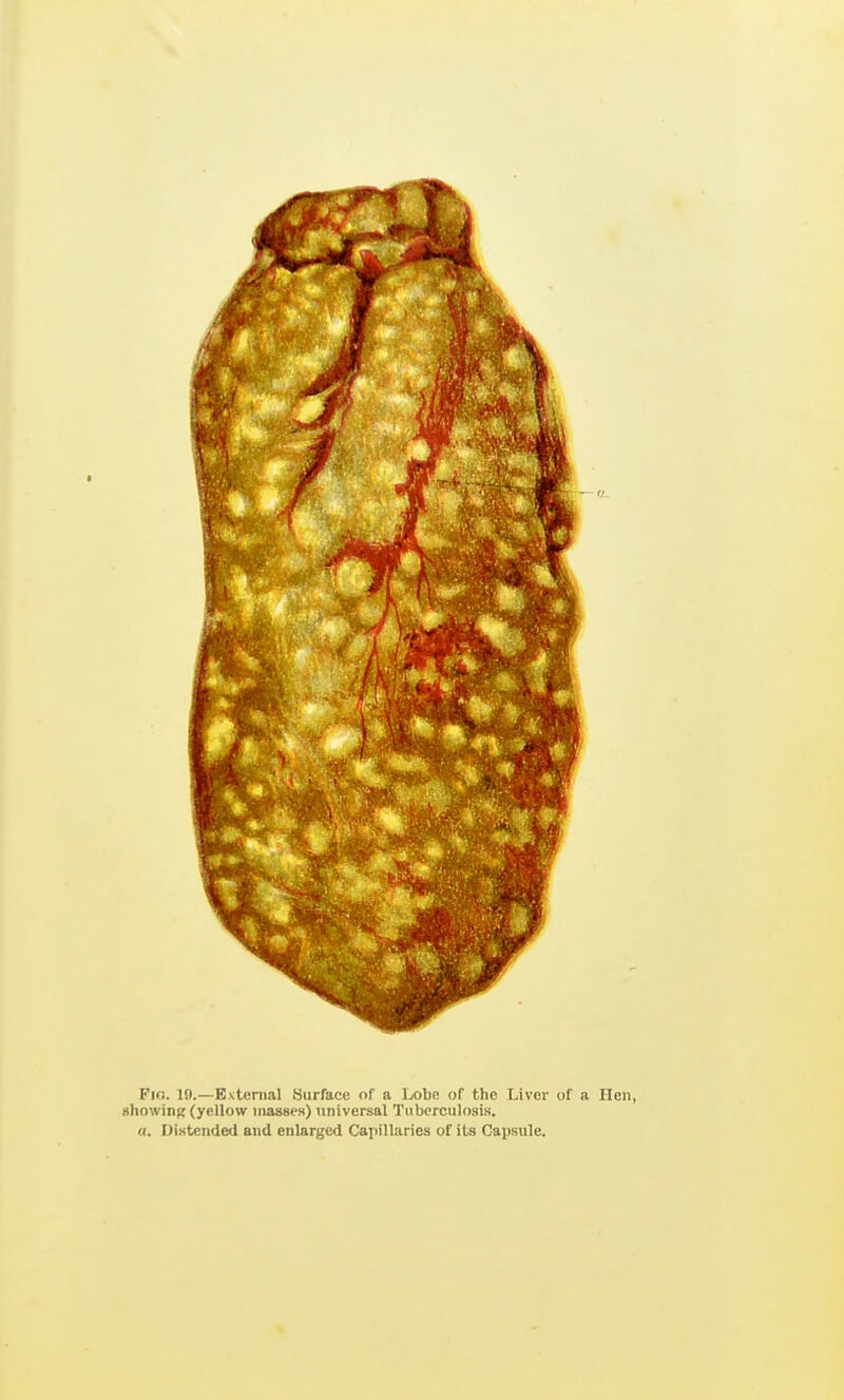 Fio. 19.—Bxtenial Surface of a Lobe of the Liver of a Hen, showiiiR (yellow inasaeH) universal Tuberculosis. u. Distended and enlarged Capillaries of its Capsule.