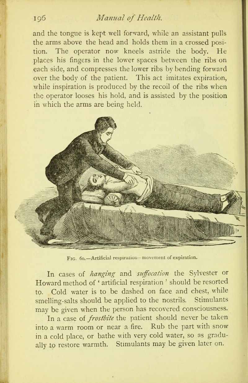 and the tongue is kept well forward, while an assistant pulls the arms above the head and holds them in a crossed posi- tion. The operator now kneels astride the body. He places his fingers in the lower spaces between the ribs on each side, and compresses the lower ribs by bending forward over the body of the patient. This act imitates expiration, while inspiration is produced by the recoil of the ribs when the operator looses his hold, and is assisted by the position in which the arms are beinsr held. In cases of hanging and s2iffocat{on the Sylvester or Howard method of ^ artificial respiration ' should be resorted to. Cold water is to be dashed on face and chest, while smelling-salts should be applied to the nostrils. Stimulants may be given when the person has recovered consciousness. In a case of frostbite the patient should never be taken into a warm room or near a fire. Rub the part with snow in a cold place, or bathe with very cold water, so as gradu- ally to restore warmth. Stimulants may be given later on.