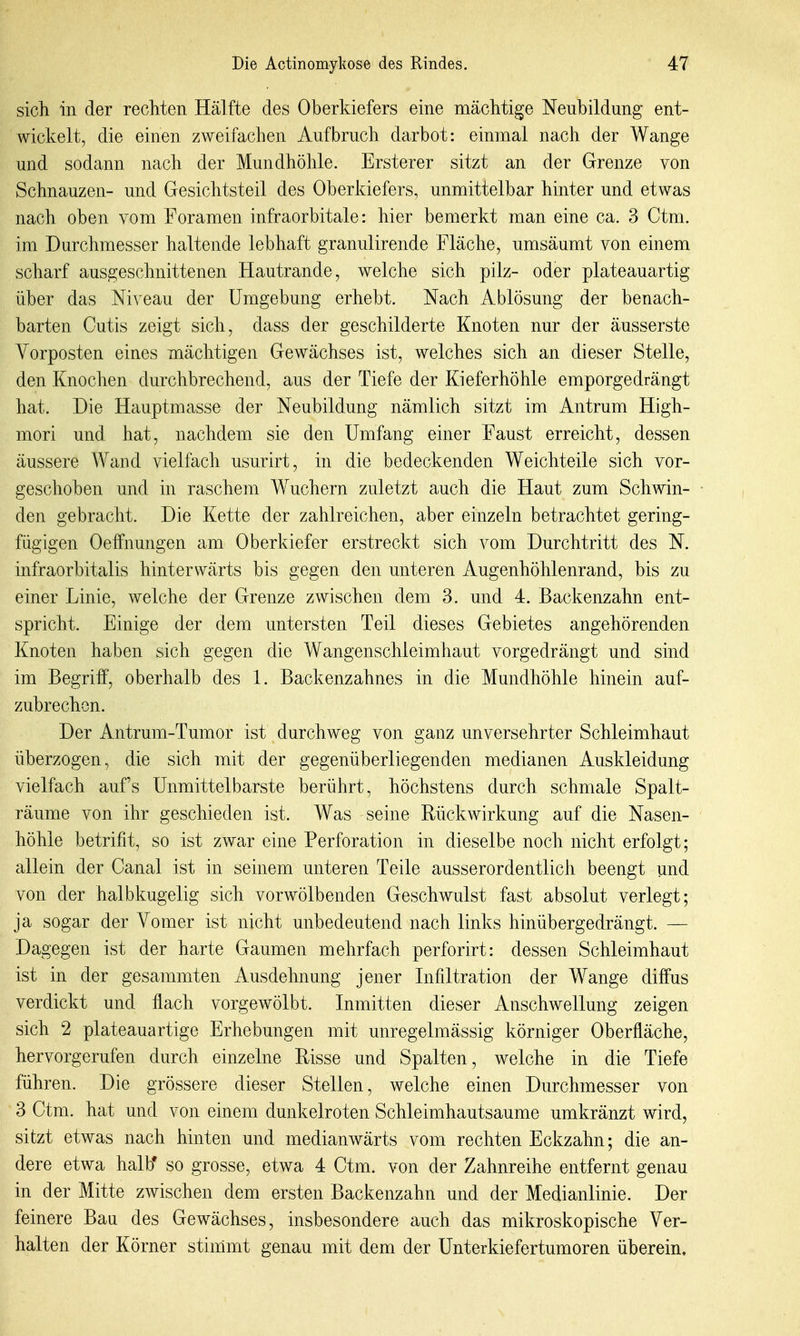 sich in der rechten Hälfte des Oberkiefers eine mächtige Neubildung ent- wickelt, die einen zweifachen Aufbruch darbot: einmal nach der Wange und sodann nach der Mundhöhle. Ersterer sitzt an der Grenze von Schnauzen- und Gesichtsteil des Oberkiefers, unmittelbar hinter und etwas nach oben vom Foramen infraorbitale: hier bemerkt man eine ca. 3 Ctm. im Durchmesser haltende lebhaft granulirende Fläche, umsäumt von einem scharf ausgeschnittenen Hautrande, welche sich pilz- oder plateauartig über das Niveau der Umgebung erhebt. Nach Ablösung der benach- barten Cutis zeigt sich, dass der geschilderte Knoten nur der äusserste Vorposten eines mächtigen Gewächses ist, welches sich an dieser Stelle, den Knochen durchbrechend, aus der Tiefe der Kieferhöhle emporgedrängt hat. Die Hauptmasse der Neubildung nämlich sitzt im Antrum High- mori und hat, nachdem sie den Umfang einer Faust erreicht, dessen äussere Wand vielfach usurirt, in die bedeckenden Weichteile sich vor- geschoben und in raschem Wuchern zuletzt auch die Haut zum Schwin- den gebracht. Die Kette der zahlreichen, aber einzeln betrachtet gering- fügigen Oeffnungen am Oberkiefer erstreckt sich vom Durchtritt des N. infraorbitalis hinterwärts bis gegen den unteren Augenhöhlenrand, bis zu einer Linie, welche der Grenze zwischen dem 3. und 4. Backenzahn ent- spricht. Einige der dem untersten Teil dieses Gebietes angehörenden Knoten haben sich gegen die Wangenschleimhaut vorgedrängt und sind im Begriff, oberhalb des 1. Backenzahnes in die Mundhöhle hinein auf- zubrechen. Der Antrum-Tumor ist durchweg von ganz unversehrter Schleimhaut überzogen, die sich mit der gegenüberliegenden medianen Auskleidung vielfach aufs Unmittelbarste berührt, höchstens durch schmale Spalt- räume von ihr geschieden ist. Was seine Rückwirkung auf die Nasen- höhle betrifit, so ist zwar eine Perforation in dieselbe noch nicht erfolgt; allein der Canal ist in seinem unteren Teile ausserordentlich beengt und von der halbkugelig sich vorwölbenden Geschwulst fast absolut verlegt; ja sogar der Yomer ist nicht unbedeutend nach links hinübergedrängt. — Dagegen ist der harte Gaumen mehrfach perforirt: dessen Schleimhaut ist in der gesammten Ausdehnung jener Infiltration der Wange diffus verdickt und flach vorgewölbt. Inmitten dieser Anschwellung zeigen sich 2 plateauartige Erhebungen mit unregelmässig körniger Oberfläche, hervorgerufen durch einzelne Risse und Spalten, welche in die Tiefe führen. Die grössere dieser Stellen, welche einen Durchmesser von 3 Ctm. hat und von einem dunkelroten Schleimhautsaume umkränzt wird, sitzt etwas nach hinten und medianwärts vom rechten Eckzahn; die an- dere etwa halb' so grosse, etwa 4 Ctm. von der Zahnreihe entfernt genau in der Mitte zwischen dem ersten Backenzahn und der Medianlinie. Der feinere Bau des Gewächses, insbesondere auch das mikroskopische Ver- halten der Körner stimmt genau mit dem der Unterkiefertumoren überein.