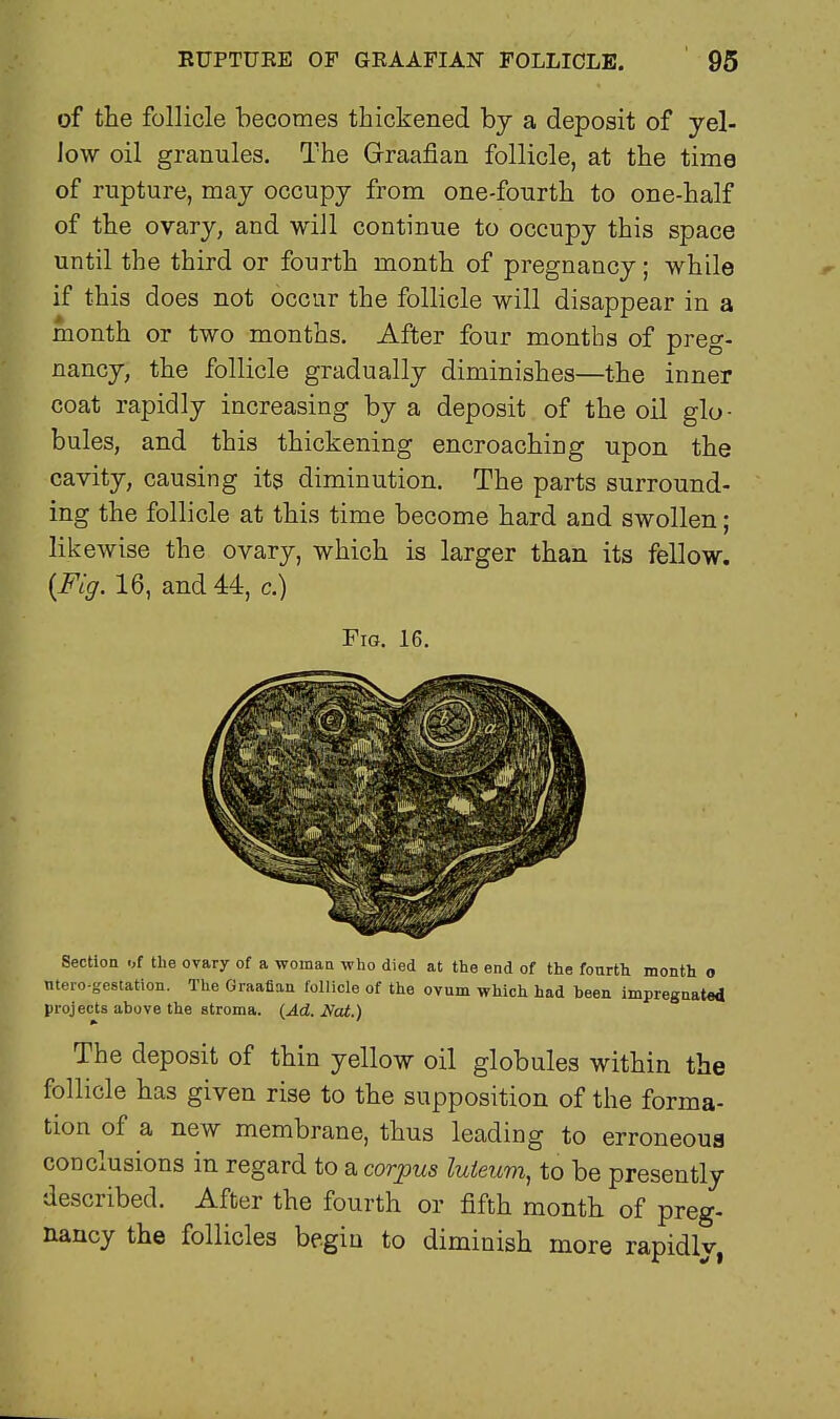 of the follicle becomes thickened by a deposit of yel- low oil granules. The Graafian follicle, at the time of rupture, may occupy from one-fourth to one-half of the ovary, and will continue to occupy this space until the third or fourth month of pregnancy; while if this does not occur the follicle will disappear in a month or two months. After four months of preg- nancy, the follicle gradually diminishes—the inner coat rapidly increasing by a deposit of the oil glo- bules, and this thickening encroaching upon the cavity, causing its diminution. The parts surround- ing the follicle at this time become hard and swollen; likewise the ovary, which is larger than its fellow. {Fig. 16, and 44, c.) Fig. 16. Section of the ovary of a woman who died at the end of the fourth month o nteio-gestation. The Graafian follicle of the ovum which had heen impregnated projects above the stroma. (Ad. Nat.) The deposit of thin yellow oil globules within the follicle has given rise to the supposition of the forma- tion of a new membrane, thus leading to erroneous conclusions in regard to a corpus luteum, to be presently described. After the fourth or fifth month of preg- nancy the follicles begin to diminish more rapidly,