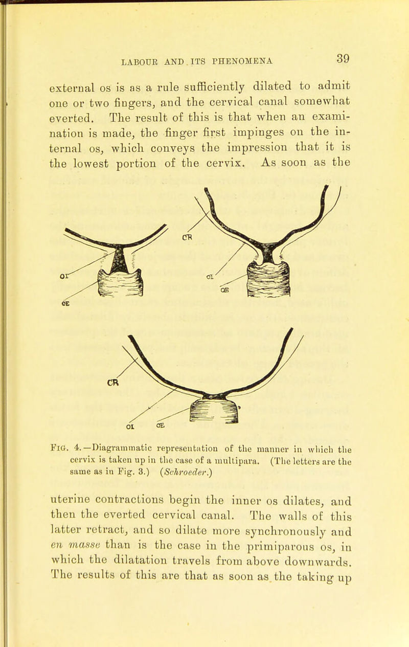 external os is as a rule sufficiently dilated to admit one or two iingers, and the cervical canal somewhat everted. The result of this is that when an exami- nation is made^ the finger first impinges on the in- ternal OS, which conveys the impression that it is the lowest portion of the cervix. As soon as the Fio. 4.—Diagrammatic represeutiitiou of the manner in wliicli tlie cervix is taken up in the case of a multipara. (The letters are the same as in Fig. 3.) (Schroeder.) uterine contractions begin the inner os dilates, and then the everted cervical canal. The walls of this latter retract, and so dilate more synchronously and en masse than is the case in the primiparous os, in which the dilatation travels from above downwards. The results of this are that as soon as. the taking up