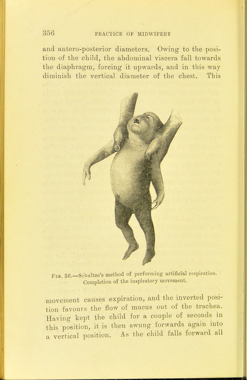 and antero-posteriol' diameters. Owing to the posi- tion of the child, the abdominal viscera fall towards the diaphragm, forcing it upwards, and in this way diminish the vertical diameter of the chest. This Fi&. 56.—Schultze's method of performing artificial respiration. Completion of the inspiratory movement. movement causes expiration, and the inverted posi- tion favours the flow oi mucus out of the trachea. Having kept the child for a couple of seconds in this position, it is then swung forwards again into a vertical position. As the child falls forward all